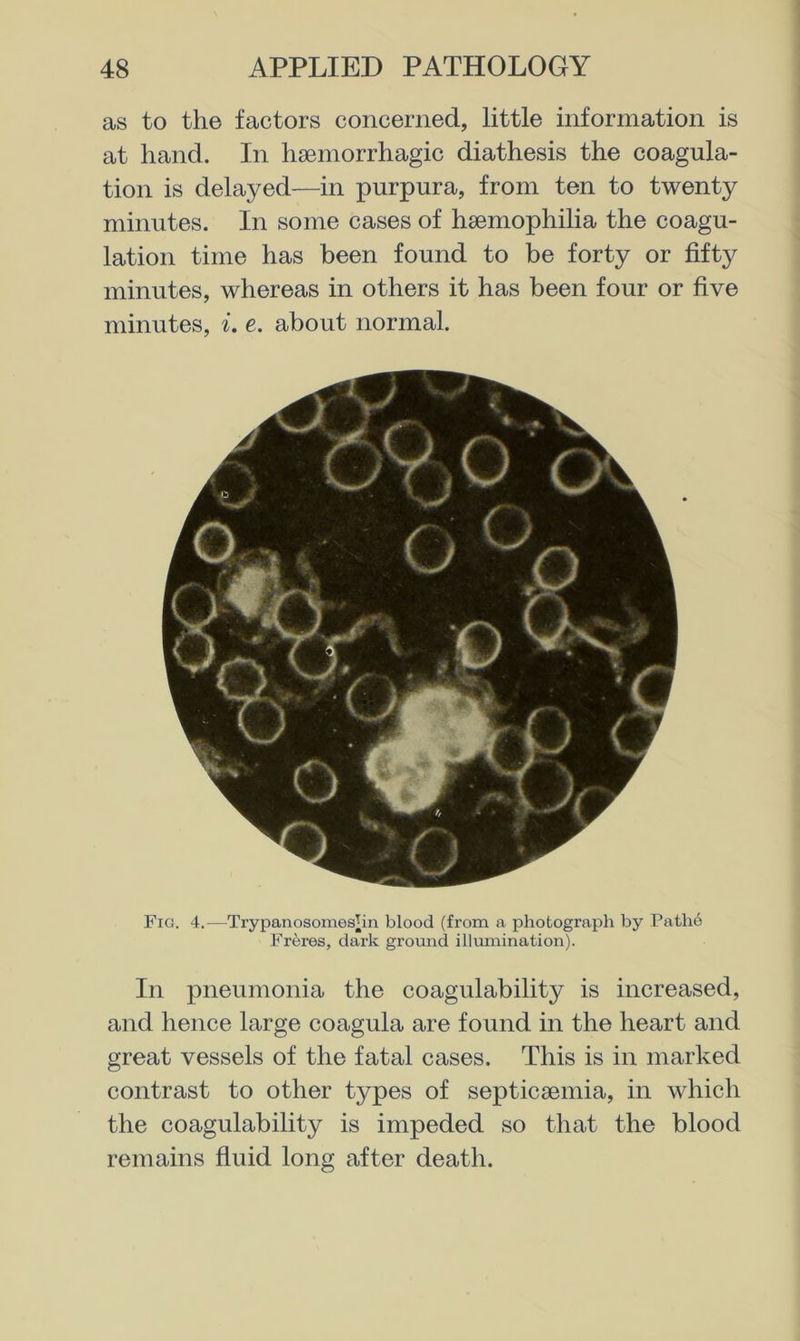 as to the factors concerned, little information is at hand. In haemorrhagic diathesis the coagula- tion is delayed—in purpura, from ten to twenty minutes. In some cases of haemophilia the coagu- lation time has been found to be forty or fifty minutes, whereas in others it has been four or five minutes, i. e. about normal. Fig. 4.—Trypanosomes^in blood (from a photograph by Pathe Freres, dark ground illumination). In pneumonia the coagulability is increased, and hence large coagula are found in the heart and great vessels of the fatal cases. This is in marked contrast to other types of septicaemia, in which the coagulability is impeded so that the blood remains fluid long after death.