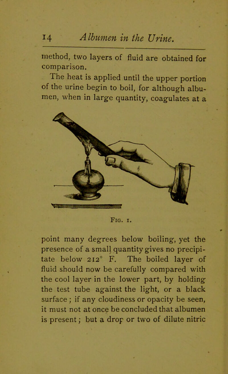 method, two layers of fluid are obtained for comparison. The heat is applied until the upper portion of the urine begin to boil, for although albu- men, when in large quantity, coagulates at a Fig. I. point many degrees below boiling, yet the presence of a small quantity gives no precipi- tate below 212° F. The boiled layer of fluid should now be carefully compared with the cool layer in the lower part, by holding the test tube against the light, or a black surface ; if any cloudiness or opacity be seen, it must not at once be concluded that albumen is present; but a drop or two of dilute nitric