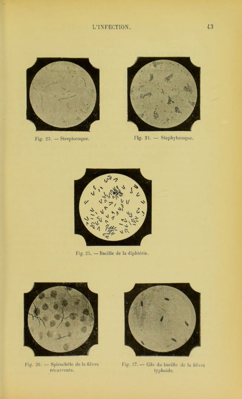 Fig. 25. — Bacille de la diphtérie. Fig. 20. — Spirochète de la fièvre récurrente. Fig. 27.— Cils du bacille de la fièvre typhoïde.