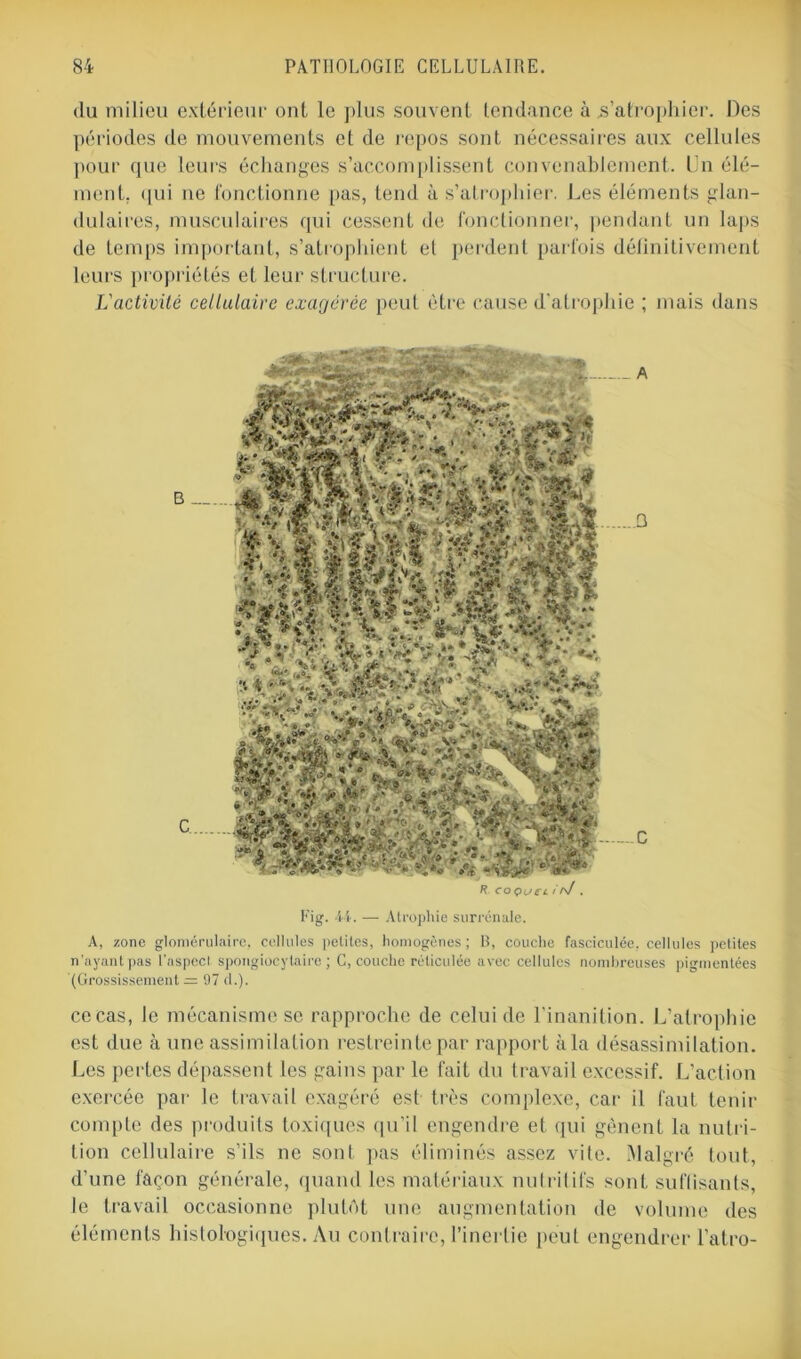 du milieu extérieur ont le plus souvent tendance à s’atrophier. Des périodes de mouvements et de repos sont nécessaires aux cellules pour que leurs échanges s’accomplissent convenablement. Un élé- ment. qui ne fonctionne pas, tend à s’atrophier. Les éléments glan- dulaires, musculaires qui cessent de fonctionner, pendant un laps de temps important, s’atrophient et perdent parfois définitivement leurs propriétés et leur structure. L'activité cellulaire exagérée peut être cause d’atrophie ; mais dans R coçueL i rj. Fig. 44. — Atrophie surrénale. A, zone glomérulaire, cellules petites, homogènes ; B, couche fasciculée, cellules petites n'ayant pas l'aspect spongiocytaire ; C, couche réticulée avec cellules nombreuses pigmentées '(Grossissement =: 97 d.). cocas, le mécanisme sc rapproche de celui de l’inanition. L’atrophie est due à une assimilation restreinte par rapport à la désassimilation. Les pertes dépassent les gains par le fait du travail excessif. L’action exercée par le travail exagéré est très complexe, car il faut tenir compte des produits toxiques qu’il engendre et qui gênent la nutri- tion cellulaire s’ils ne sont pas éliminés assez vite. Malgré tout, d’une façon générale, quand les matériaux nutritifs sont suffisants, le travail occasionne plutôt une augmentation de volume des éléments histologiques. Au contraire, l’inertie peut engendrer l’atro-