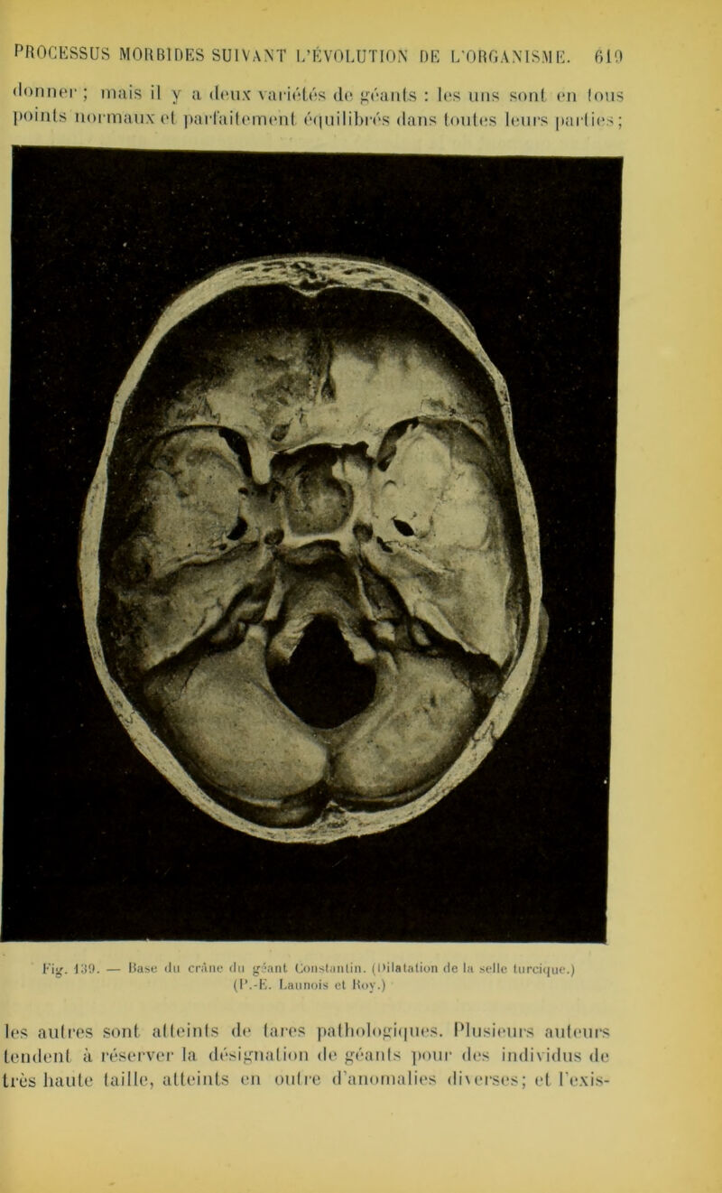 donner ; mais il y a deux variétés de géants : les uns sont en Inus points normaux et parfaitement équilibrés dans toutes leurs parties; t'ig. 139. — Base du crâne du géant Constantin. (Dilatation de la selle turcique.) (l’.-E. Launois et Boy.) les autres sont atteints de tares pathologiques. Plusieurs auteurs tendent à réserver la désignation de géants pour des individus de très haute taille, atteints en outre d’anomalies diverses; et l'exis-