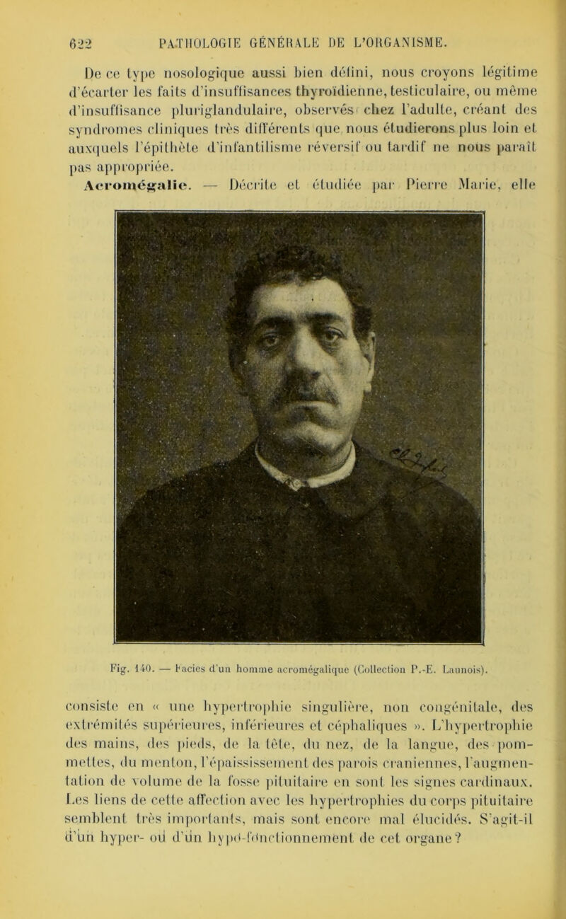 De ce type nosologique aussi bien délini, nous croyons légitime d’écarter les l'aiLs d’insuffisances thyroïdienne, testiculaire, ou même d’insuffisance pluriglandulaire, observés* chez l’adulte, créant des syndromes cliniques 1res différents que nous étudierons plus loin et auxquels l’épithète d’infantilisme réversif ou tardif ne nous paraît pas appropriée. Acromégalie. — Décrite et étudiée par Pierre Marie, elle Fig. 140. — hacies d’un homme acromégalique (Collection P.-E. Launois). consiste en « une hypertrophie singulière, non congénitale, des extrémités supérieures, inférieures et céphaliques ». L’hypertrophie des mains, des pieds, de la tète, du nez, de la langue, des pom- mettes, du menton, l’épaississement des parois crâniennes, l’augmen- tation de volume de la fosse pituitaire en sont les signes cardinaux. Les liens de cette affection avec les hypertrophies du corps pituitaire semblent très importants, mais sont, encore mal élucidés. S’agit-il d’im hyper- oii d’un hypd-fdnctionnemfent de cet organe?