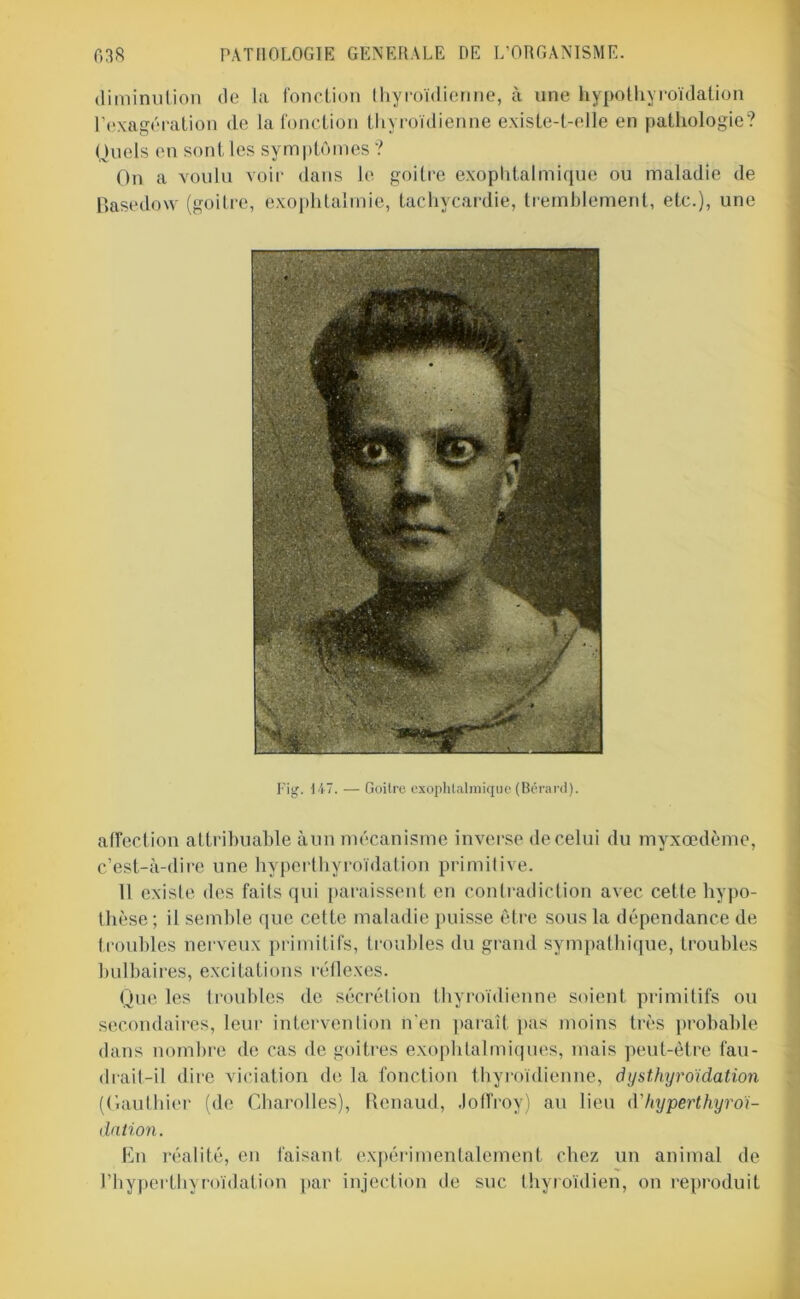 diminution de la fonction thyroïdienne, à une hypothyroïdation l’exagération de la fonction thyroïdienne existe-t-elle en pathologie? Quels en sont les symptômes ? On a voulu voir dans le goitre exophtalmique ou maladie de Basedow (goitre, exophtalmie, tachycardie, tremblement, etc.), une Fig. 147. — Goitre exophtalmique (Bérard). affection attribuable àun mécanisme inverse de celui du myxœdème, c’est-à-dire une hyperthyroïdation primitive. 11 existe des faits qui paraissent en contradiction avec cette hypo- thèse ; il semble que cette maladie puisse être sous la dépendance de troubles nerveux primitifs, troubles du grand sympathique, troubles bulbaires, excitations réflexes. Que les troubles de sécrétion thyroïdienne soient primitifs ou secondaires, leur intervention n'en paraît pas moins très probable dans nombre de cas de goitres exophtalmiques, mais peut-être fau- drait-il dire viciation de la fonction thyroïdienne, dysthyroïdation (Gauthier (de Charolles), Renaud, Jotfroy) au lieu d’hyperthyroi- dation. En réalité, en faisant expérimentalement chez un animal de l’hyperthyroïdation par injection de suc thyroïdien, on reproduit