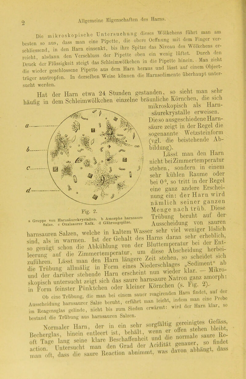 Die mikroskopische Untersuchung dieses Wölkchens führt man am besten so aus, dass man eine Pipette, die obere Oeffnung mit dem Finger ver- schliessend, in den Harn einsenkt, bis ihre Spitze das Niveau des Wölkchens er- reicht alsdann den Verschluss der Pipette oben ein wenig lüftet. Durch den Druck der Flüssigkeit steigt das Schleimwölkchen in die Pipette hinein. Man zieht die wieder geschlossene Pipette aus dem Harn heraus und lasst auf einem Object träger austropfen. In derselben Weise können die Harnsedimente überhaupt unter- sucht werden. Hat der Harn etwa 24 Stunden gestanden, so sieht man sehr häufig in dem Schleimwölkchen einzelne bräunliche Körnchen die sich mikroskopisch als tiarn- säurekrystalle erweisen. Die so ausgeschiedene Harn- säure zeigt in der Hegel die sogenannte Wetzsteinform (vgl. die beistehende Ab- bildung). Lässt man den Harn nicht bei Zimmertemperatur stehen, sondern in einem sehr kühlen Raume oder bei 0 °, so tritt in der Regel eine ganz andere Erschei- nung ein: der Harn wird nämlich seiner ganzen Menge nach trüb. Diese Trübung beruht auf der Ausscheidung von sauren a Gruppe von Harnsäurekrystallen. b Amorphe harnsaurc Salze, c Oxalsaurcr Kalk, d Gahrungsp.lze. fi;P Triibune allmalig m rorm ° und der darüber stehende Harn erscheint nun wieder amQJv ^ skopisch untersucht zeigt sich das saure harnsauie < §c in Form feinster Pünktchen oder kleiner Körnchen (>. 1 «• Ob eine Trübung, die man bei einem sauer reagirenden Hain in , Ausscheidung harnsaurer Salze beruht, erfährt man leicht, indem man eine P tu Heagcnsglas gelinde, nicht bis zum Sieden erwärmt: wird der Harn klar, so bestand die Trübung aus harnsauren Salzen. , Normaler Ham, Oer in ciir sehr sorglaltig gerou^ass. Normaler Harn, der m ein sein b . Bechcrglas, hinein entleert ist ^normale saure Re- oft Tage lang seine klare Beschaffenheit und di ^ so findet action. Untersucht man den Grad der f ‘ difvon abhängt, dass man oft, dass die saure Rcact.on abmmmt, was davon 6