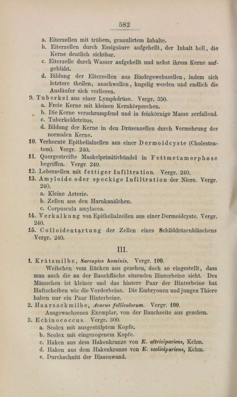 a. Eiterzellen mit trübem, graiiulirtem Inhalte. b. Eiterzellen durch Essigsäure aufgehellt, der Inhalt hell, die Kerne deutlich sichtbar. c. Eiterzelle durch Wasser aufgehellt mid nebst ihrem Kerne auf- gebläht. d. Bildung der Eiterzellen aus Bindegewebszellen, indem sich letztere theilen, anschwellen, kugelig werden und endlich die Ausläufer sich verlieren. 9. Tuberkel aus einer Lymphdrüse. Vergr. 350. a. Freie Kerne mit kleinen Kernkörperchen. ^ b. Die Kerne verschrumpfend und in feinkörnige Masse zerfallend. c. Tuberkeldetritus. d. Bildung der Kerne in den Drüsenzellen durch Vermehrung der normalen Kerne. 10. Verhornte Epithelialzellen aus einer Dermoidcyste (Cholestea- tom). Vergr. 240. 11. Quergestreifte Muskelprimitivbündel in Fettmetamorphose begriffen. Vergr. 240. 12. Leberzpllen mit fettiger Infiltration. Vergr. 240. 13. Amyloide oder speckige Infiltration der Niere. Vergr. 240. a. Kleine Arterie. b. Zellen aus den Harnkanälchen. c. Corpuscula amylacea. 14. Verkalkung von Epithelialzellen aus einer Dermoidcyste. Vergr. 240. 15. C 011 oidentar tung der Zellen eines Schilddrüsenbläschens Vergr. 240. III. 1. Krätzmilbe, Sarcoples hominis. Vergr. 100. Weibchen vom Bücken aus gesehen, doch so eingestellt, dass man auch die an der Bauchfläche sitzenden Hinterbeine sieht. Des Männchen ist kleiner und das hintere Paar der Hinterbeine hat Haftscheiben wie die Vorderbeine. Die Embryonen und jungen Thiere haben nur ein Paar Hinterbeine. 2. Haarsackmilbe, Acarus folliculorum. Vergr. 100. Ausgewachsenes Exemplar, von der Bauchseite aus gesehen. 3. Echinococcus. Vergr. 300. a. Scolex mit ausgestülptem Kopfe. b. Scolex mit eingezogenem Kopfe. c. Haken aus dem Hakenkranze von E. altricipariensy Kchm. d. Haken aus dem Hakenkranze von E. scolicipariens, Kchm. e. Durchschnitt der Blasenwand.