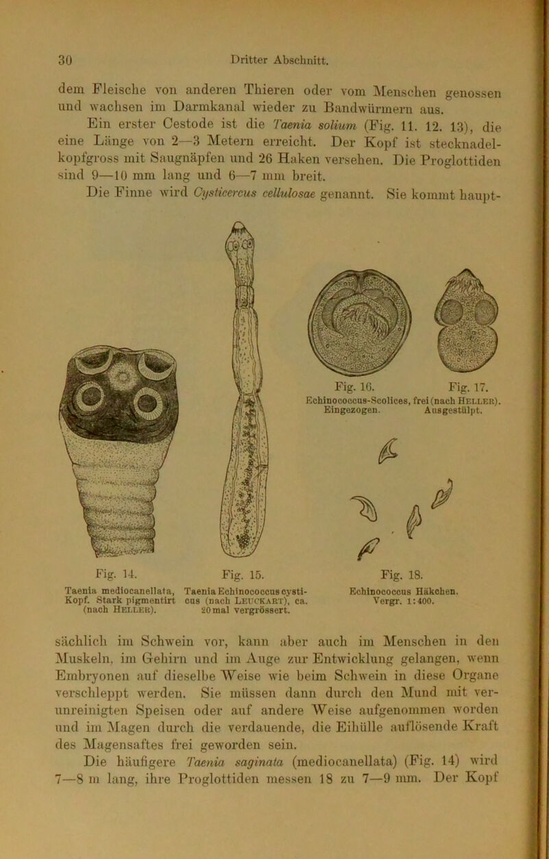 dem Fleische von anderen Thieren oder vom ^Menschen genossen und wachsen im Darmkanal wieder zu Bandwürmern aus. Ein erster Cestode ist die Taenia solium (Fig. 11. 12. 13), die eine Länge von 2—3 Metern erreicht. Der Ko})f ist stecknadel- kopfgross mit Saugnäpfen und 26 Haken versehen. Die Proglottiden sind 9—10 mm lang und 6—7 mm breit. Die Finne wird Cysticercus cellulosae genannt. Sie kommt haui)t- Fig. U. Fig. 15. Fig. 18. Taenia mediocanellata, Taenia Echinococcas cysti- Echinococcns Häkchen. Kopf. Stark pigmentirt oas (nach Leuckart), ca. Vergr. i:400. (nach Heller). 20 mal vergrössert. sächlich im Schw'ein vor, kann aber auch im Menschen in den Muskeln, im Gehirn und im Auge zur Entwicklung gelangen, wenn Embryonen auf dieselbe Weise wie beim Schwein in diese Organe verschleppt werden. Sie. müssen dann durch den Mund mit ver- unreinigten Speisen oder auf andere Weise aufgenommen worden und im ]Magen durch die verdauende, die Eihülle auflösende Kraft des Magensaftes frei geworden sein. Die häufigere Taenia saginaia (mediocanellata) (Fig. 14) wird 7—8 m lang, ihre Proglottiden messen 18 zu 7—9 mm. Der Kopf