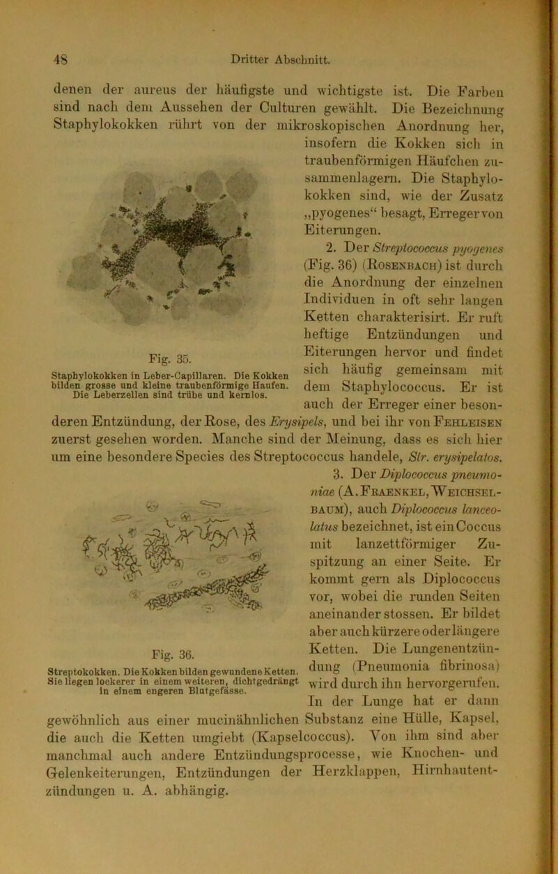 denen der aureus der liäufigste und wichtigste ist. Die li’arben sind nach dem Aussehen der Culturen gewählt. Die Bezeichnung Staphylokokken i-ührt von der mikroskopischen Anordnung her, insofern die Kokken sich in traubenförmigen Häufchen zu- sammeulageni. Die Staphylo- kokken sind, wie der Zusatz „pyogenes“ besagt, Erregervon Eiterungen. 2. Der Streptococcus pyogenes (Fig. 36) (Rosenhach) ist durch die Anordnung der einzelnen Individuen in oft sehr langen Ketten charakterisirt. Er ruft heftige Entzündungen und Eiterungen hervor und findet sich häufig gemeinsam mit dem Staphylococcus. Er ist auch der Erreger einer beson- deren Entzündung, der Rose, Erysipels, und bei ihr von Fehleisen zuerst gesehen worden. Manche sind der Meinung, dass es sich hier um eine besondere Species des Streptococcus handele, Sir. erysipelatos. 3. Diplococcus pneumo- niae (A.Fraenkel,’Weiohsel- baum), auch Diplococcus kmceo- latus bezeichnet, ist einCoccus mit lanzettförmiger Zu- spitzung an einer Seite. Er kommt gern als Diplococcus vor, wobei die runden Seiten aneinander stossen. Er bildet aber auch kürzere oder längere Ketten. Die Lungenentzün- dung (Pneumonia fibrinosa) wird durch ihn hervorgenifen. In der Lunge hat er dann Fig. 35. Staphylokokken in Leber-Capillaren. Die Kokken bilden grosse nnd kleine tranbenfönnige Haufen. Die Leberzellen sind trübe und kernlos. Fig. 36. Streptokokken. Die Kokken bilden gewundene Ketten. Sie liegen lockerer in einem weiteren, dichtgedrängt in einem engeren Blutgefässe. gewöhnlich aus einer mucinähnlichen Substanz eine Hülle, Kapsel, die auch die Ketten umgieht (Kapselcoccus). Von ihm sind aber manchmal auch andere Entzündungsprocesse, wie Knochen- und Gelenkeiterungen, Entzündungen der Herzklappen, Hirnhautent- zündungen u. A. abhängig.