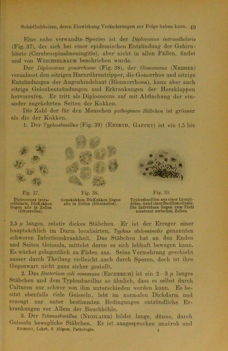 Eine nahe verwandte Species ist der Diplococcus intracellularis (Fig. 37), der sich bei einer epidemischen Entzündung der Gehirn- häute (Cerebrospinalmeningitis), aber niclit in allen Fällen, bildet lind von Weichselbaum beschrieben wurde. Der Diplococcus gonorrhoeae (Fig. 38), der Gonococcus (Neissek) veranlasst den eitrigen Harnröhrentripper, die Gonorrhoe und eitrige Entzündungen der Augenbindehant (Blennorrhoea), kann aber auch eitrige Gelenkentzündungen und Erkrankungen der Herzklappen hervorrnfen. Er tritt als Diplococcus auf mit Abdachung der ein- ander zugekehrten Seiten der Kokken. Die Zahl der für den Menschen pathogenen Stäbchen ist grösser als die der Kokken. 1. Der Typhnshadllus (Fig. 39) (Ebekth, Gafeky) ist ein 1,5 bis Fig. 37. Fig. 38. Fig. 39. Diiilococcns intra- Gonokokken. DieKokken liegen cellnlaris. DieKokken alle in Zellen (Elterzellen), liegen alle in Zellen (Elterzellen). Typüusbacillen aus einer Lymph- drüse. Rand einer Baoillencolonie. Die Individuen liegen zum Theil zerstreut zwiscnen Zellen. 2,5 g langes, relativ dickes Stäbchen. Er ist der Erreger einer hauptsächlich im Darm localisirten, Typhus abdominalis genannten schweren Infectionskrankheit. Das Stäbchen hat an den Enden und Seiten Geissein, mittelst deren es sich lebhaft bewegen kann. Es wächst gelegentlich zu Fäden aus. Seine Vermehrung geschieht ausser durch Theilung vielleicht auch durch Sporen, doch ist ihre Gegenwart nicht ganz sicher gestellt. 2. Das Bactcrium coli commune (Escherich) ist ein 2—3 g langes Stäbchen und dem Typhusbacillus so ähnlich, dass es seihst durch Culturen nur schwer von ihm unterschieden werden kann. Es be- sitzt ebenfalls viele Geissein, lebt im normalen Dickdarm und erzeugt nur unter bestimmten Bedingungen entzündliche Er- krankungen vor Allem der Bauchhöhle. 3. Der Tetanusbacillus (Nicolaieu) bildet lange, dünne, durch Geisseln bewegliche Stäbchen. Er ist ausgesprochen anaerob und Rikbekt, Lehrb. d. Allgem. Pathologie. 4