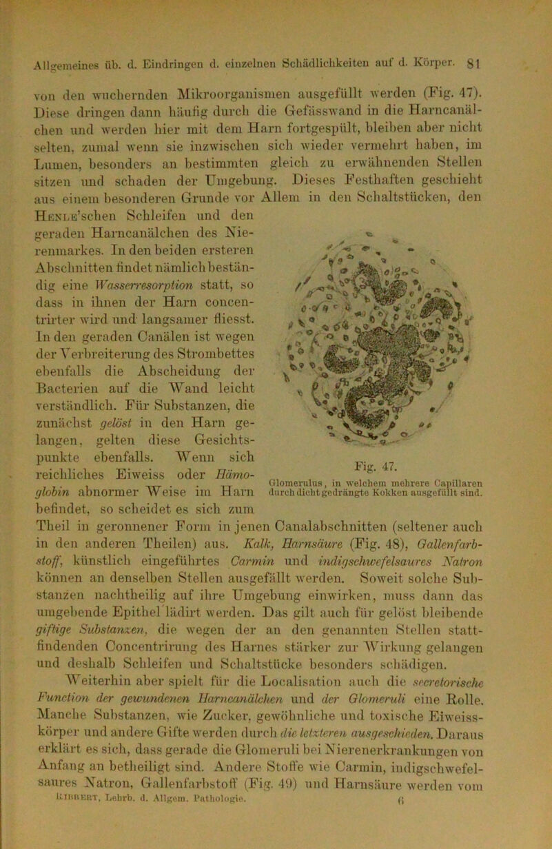 von den wnchermlen Mikroorganismen ausgefüllt Averden (Fig. 47). Diese dringen dann liiluHg durch die Gefässwand in die Harncanäl- chen und -werden hier mit dem Harn fortgespült, bleihen aber nicht selten, zumal -wenn sie inzwischen sich wieder vermehrt haben, im Lumen, besonders an bestimmten gleich zu erwähnenden Stellen sitzen und schaden der Umgebung. Dieses Festhaften geschieht aus einem besonderen Grunde vor Allem in den Schaltstücken, den HKNUä’schen Schleifen und den geraden Harncanälchen des Nie- renmarkes. In den beiden ersteren iibschnitten bildet nämlich bestän- dig eine Wassciresorption statt, so dass in ihnen der Harn concen- trirter wird und langsamer tliesst. ln den geraden Canälen ist wegen der Verbreiterung des Strombettes ebenfalls die Abscheidung der Bacterien auf die Wand leicht verständlich. Für Substanzen, die zunächst gelöst in den Harn ge- langen, gelten diese Gesichts- punkte ebenfalls. Wenn sich reichliches Eiweiss oder Hämo- . __ . . ,, (»lomerulus, in welchem mehrere Capillaren glooin abnormer \V eise IIU .H ai*ll durch dicht gedrängte Kokken ausgelülH sind. befindet, so scheidet es sich zum Theil in geronnener Form in jenen Canalahschnitten (seltenerauch in den anderen Theilen) aus. Kalk, Harnsäure (Fig. 18), Oallenfarb- stoff, künstlich eingeführtes Garmin und indigschwcfelsaures Nairon können an denselben Stellen ausgefällt werden. Soweit solche Sub- stanzen nachtbeilig auf ihre Umgebung einwirken, muss dann das umgehende Epithel lädirt werden. Das gilt auch für gelöst bleibende giftige Suhstanxen, die wegen der an den genannten Stellen statt- findenden Concentrirung des Harnes stärke]' zui' Wii'kung gelangen und deshalb Schleifen und Schaltstücke besonders schädigen. Weiterhin aber spielt für die Localisation auch die srcretorischc Fimction der gewundenen Harncanälclten und der Glomeruli eine Holle. Manche Sul)stanzen, wie Zucker, gewöhnliche und toxische Eiweiss- körpei' und andere Gifte werden dui'ch die letzteren ausgeschieden. Daraus erklärt es sich, dass gerade die Glomeruli bei Nierenerkrankungen von Anfang an betheiligt sind. Andere Stoffe wie Carmin, indigschwefel- saures Xatron, Gallenfarl)stolf (Fig. 49) und Harnsäure werden vom UiitiiERT, Tjelirb. d. Allgem. Pathologie. (j t. Fig. 47.