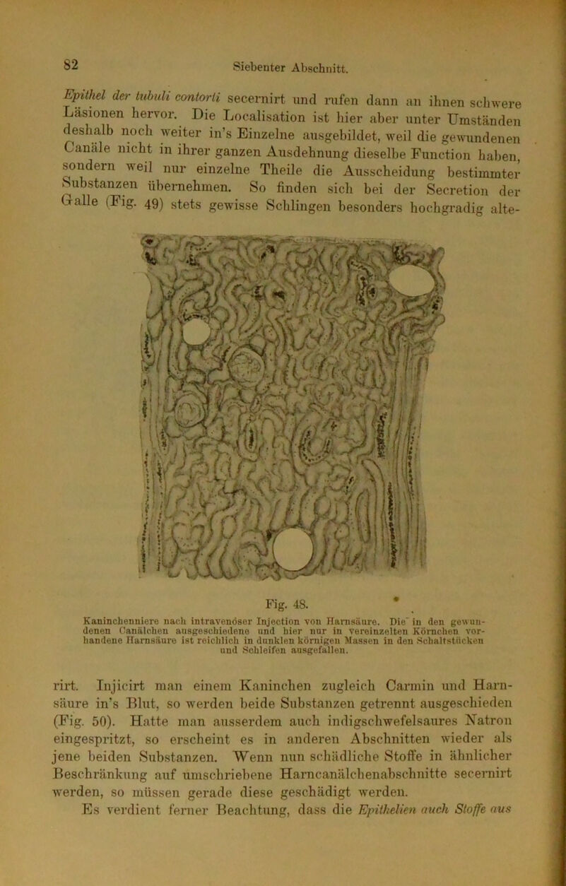 Epithel der tubuli contorli secernirt und rufen dann an ihnen sdnvere Läsionen hervor. Die Localisation ist liier aber unter Umständen deshalb noch weiter in’s Einzelne ausgebildet, weil die gewundenen Canäle nicht in ihrer ganzen Ausdehnung dieselbe Function haben, son^dern weil nur einzelne Theile die Ausscheidung bestimmter Substanzen übernehmen. So finden sich bei der Secretion der Calle (Fig. 4g) stets gewisse Schlingen besonders hochgi-adig alte- Kanincheiiuiere nach intravenöser Injection von Hanisäure. Die’ in den gew un- denen Canälchen ansgeschiedene und hier nur in vereinzelten Körnchen vor- handene Itamsäure ist reichlich in dunklen körnigen Massen in den Schaltstücken und Schleifen ausgefallen. rirt. Injicirt man einem Kaninchen zugleich Carmin und Harn- säure in’s Blut, so werden beide Substanzen getrennt ausgeschieden (Fig. 50). Hatte man ausserdem auch indigschwefelsaures Natron eingespritzt, so erscheint es in anderen Abschnitten wieder als jene beiden Substanzen. Wenn min schädliche Stoffe in ähnlicher Beschränkung auf umschriebene Harncanälchenabschnitte secernirt werden, so müssen gerade diese geschädigt werden. Es verdient ferner Beachtung, dass die Epiihdien mich Stoffe aus