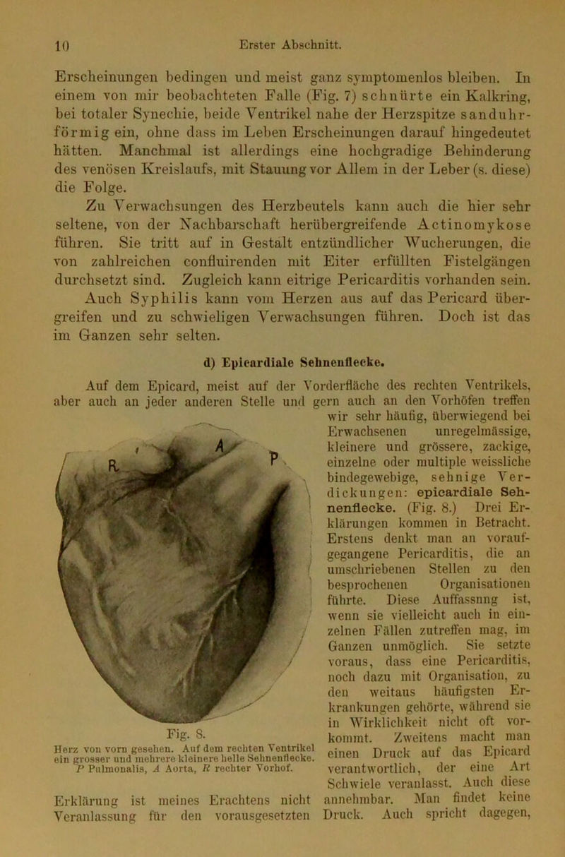 Erscheinungen bedingen und meist ganz symptomenlos bleiben. In einem von mir beobachteten Falle (Fig. 7) schnürte ein Kalkring, bei totaler Synechie, beide Ventrikel nahe der Herzspitze sanduhr- förmig ein, ohne dass im Leben Erscheinungen darauf hingedeutet hätten. Manchmal ist allerdings eine hochgradige Behinderung des venösen Kreislaufs, mit Stauung vor Allem in der Leber (s. diese) die Folge. Zu Verwachsungen des Herzbeutels kann auch die hier sehr seltene, von der Nachbarschaft herübergreifende Actinomykose führen. Sie tritt auf in Gestalt entzündlicher Wucherungen, die von zahlreichen confluirenden mit Eiter erfüllten Fistelgängen durchsetzt sind. Zugleich kann eitrige Pericarditis vorhanden sein. Auch Syphilis kann vom Herzen aus auf das Pericard über- greifen und zu schwieligen Verwachsungen führen. Doch ist das im Ganzen sehr selten. d) Epioardiale Sebneufleeke. Auf dem Epicard, meist auf der Vorderfläche des rechten Ventrikels, aber auch an jeder anderen Stelle und gern auch an den Vorhöfen treffen wir sehr häutig, überwiegend bei Erwachsenen unregelmässige, kleinere und grössere, zackige, einzelne oder multiple weissliche bindegewebige, sehnige Ver- dickungen: epioardiale Seh- nenflecke. (Fig. 8.) Drei Er- klärungen kommen in Betracht. Erstens denkt man an vorauf- gegangene Pericarditis, die an umschriebenen Stellen zu den besprochenen Organisationen führte. Diese Auffassung ist, wenn sie vielleicht auch in ein- zelnen Fällen zutreffen mag, im Ganzen unmöglich. Sie setzte voraus, dass eine Pericarditis, noch dazu mit Organisation, zu den weitaus häufigsten Er- krankungen gehörte, während sie in Wirklichkeit nicht oft vor- Fig. 8. Herz von vorn gesehen. Auf dem rechten Ventrikel ein grosser und mehrere kleinere helle Sehnentleeke. P Pulmonalis, A Aorta, R rechter Vorhof. Erklärung ist meines Erachtens nicht Veranlassung für den vorausgesetzten kommt. Zweitens macht man einen Druck auf das Epicard verantwortlich, der eine Art Schwiele veranlasst. Auch diese annehmbar. Man findet keine Druck. Auch spricht dagegen,