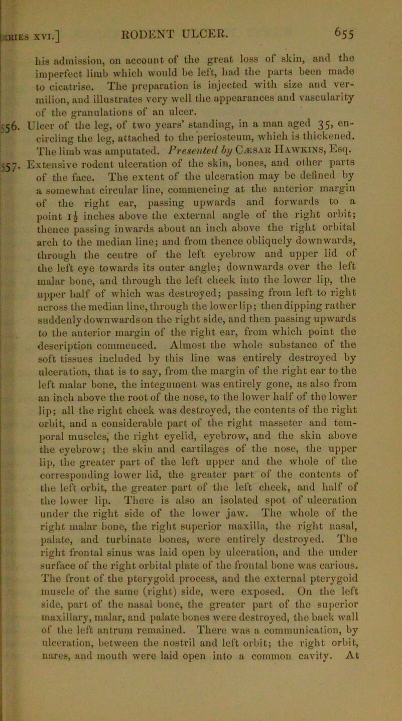 t UtlES XVI.] his admission, on account of the great loss ot skin, and the imperfect limb which would be left, had the parts been made to cicatrise. The preparation is injected with size and ver- milion, and illustrates very well the appearances and vascularity of the granulations of an ulcer. 56. Ulcer of the leg, of two years’ standing, in a man aged 35, en- circling the leg, attached to the periosteum, which is thickened. The limb was amputated. Presented by CLesaii Hawkins, Esq. 557. Extensive rodent ulceration of the skin, bones, and other parts of the face. The extent of the ulceration may be defined by a somewhat circular line, commencing at the anterior margin of the right ear, passing upwards and forwards to a point 11 inches above the external angle of the right orbit; thence passing inwards about an inch above the right orbital arch to the median line; and from thence obliquely downwards, through the centre of the left eyebrow and upper lid of the left eye towards its outer angle; downwards over the left malar bone, and through the left cheek into the lower lip, the upper half of which was destroyed; passing from left to right across the median line, through the lower lip; then dipping rather suddenly downwards on the right side, and then passing upwards to the anterior margin of the right ear, from which point the description commenced. Almost the whole substance of the soft tissues included by this line was entirely destroyed by ulceration, that is to say, from the margin of the right ear to the left malar bone, the integument was entirely gone, as also from an inch above the root of the nose, to the lower half of the lower lip; all the right cheek was destroyed, the contents of the right orbit, and a considerable part of the right masseter and tem- poral muscles, the right eyelid, eyebrow, and the skin above the eyebrow; the skin and cartilages of the nose, the upper lip, the greater part of the left upper and the whole of the corresponding lower lid, the greater part of the contents of the left orbit, the greater part of the left cheek, and half of the lower lip. There is also an isolated spot of ulceration under the right side of the lower jaw. The whole of the right malar bone, the right superior maxilla, the right nasal, palate, and turbinate bones, were entirely destroyed. The right frontal sinus was laid open by ulceration, and the under surface of the right orbital plate of the frontal bone was carious. The front of the pterygoid process, and the external pterygoid muscle of the same (right) side, were exposed. On the left side, part of the nasal bone, the greater part of the superior maxillary, malar, and palate bones were destroyed, the back wall of the left antrum remained. There Avas a communication, by ulceration, between the nostril and left orbit; the right orbit, nares, and mouth were laid open into a common cavity. At