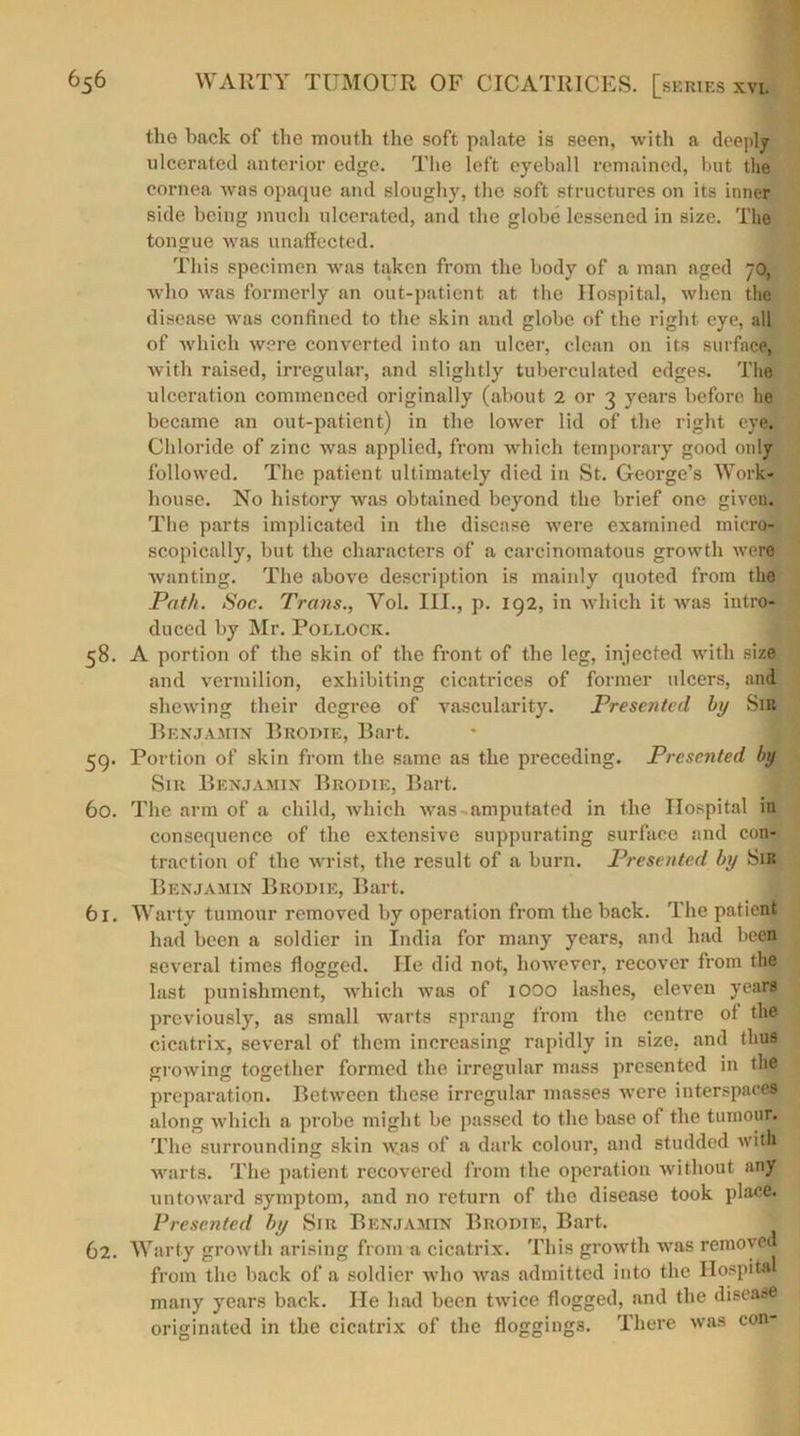 the back of the mouth the soft palate is seen, with a deeply ulcerated anterior edge. The left eyeball remained, but the cornea was opaque and sloughy, the soft structures on its inner side being much ulcerated, and the globe lessened in size. The tongue was unaffected. This specimen was taken from the body of a man aged 70, who was formerly an out-patient at the Hospital, when the disease was confined to the skin and globe of the right eye, all of which were converted into an ulcer, clean on its surface, with raised, irregular, and slightly tuberculated edges. The ulceration commenced originally (about 2 or 3 years before he became an out-patient) in the lower lid of the right eye. Chloride of zinc was applied, from which temporary good only followed. The patient ultimately died in St. George’s Work- house. No history was obtained beyond the brief one given. The parts implicated in the disease were examined micro- scopically, but the characters of a carcinomatous growth were wanting. The above description is mainly quoted from the Path. Soc. Trans., Yol. III., p. 192, in which it was intro- duced by Mr. Pollock. 58. A portion of the skin of the front of the leg, injected with size and vermilion, exhibiting cicatrices of former ulcers, and shewing their degree of vascularity. Presented by Sir Benjamin Brodie, Bart. 59. Portion of skin from the same as the preceding. Presented by Sir Benjamin Brodie, Bart. 60. The arm of a child, which was amputated in the Hospital in consequence of the extensive suppurating surface and con- traction of the wrist, the result of a burn. Presented by Sir Benjamin Brodie, Bart. 61. Warty tumour removed by operation from the back. The patient had been a soldier in India for many years, and had been several times flogged. lie did not, however, recover from the last punishment, which was of 1000 lashes, eleven years previously, as small warts sprang from the centre ot the cicatrix, several of them increasing rapidly in size, and thus growing together formed the irregular mass presented in the preparation. Between these irregular masses were interspaces along which a probe might be passed to the base of the tumour. The surrounding skin was of a dark colour, and studded with warts. The patient recovered from the operation without any untoward symptom, and no return of the disease took place. Presented by Sir Benjamin Brodie, Bart. ^ 62. Warty growth arising from a cicatrix. This growth was removed from the back of a soldier who was admitted into the Hospital many years back. He had been twice flogged, and the disease originated in the cicatrix of the floggings. There was con-