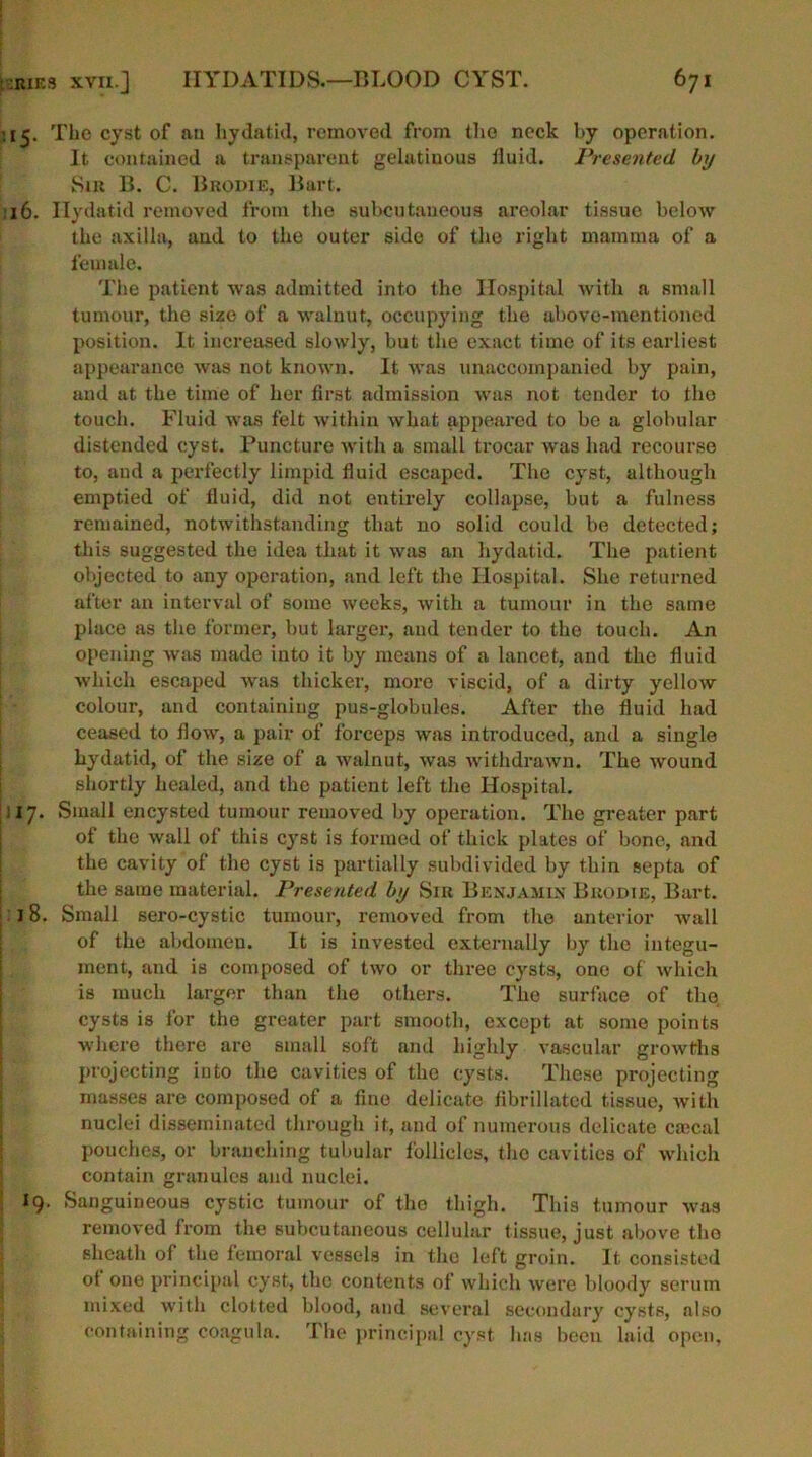 15. The cyst of an hydatid, removed from the neck by operation. It contained a transparent gelatinous fluid. Presented by Sir B. C. Brodie, Bart. 16. Hydatid removed from the subcutaneous areolar tissue below the axilla, and to the outer side of the right mamma of a female. The patient was admitted into the Hospital with a small tumour, the size of a walnut, occupying the above-mentioned position. It increased slowly, but the exact time of its earliest appearance was not known. It was unaccompanied by pain, and at the time of her first admission was not tender to the touch. Fluid was felt within what appeared to be a globular distended cyst. Puncture with a small trocar was had recourse to, and a perfectly limpid fluid escaped. The cyst, although emptied of fluid, did not entirely collapse, but a fulness remained, notwithstanding that no solid could be detected; this suggested the idea that it was an hydatid. The patient objected to any operation, and left the Hospital. She returned after an interval of some weeks, with a tumour in the same place as the former, but larger, aiul tender to the touch. An opening was made into it by means of a lancet, and the fluid which escaped was thicker, more viscid, of a dirty yellow colour, and containing pus-globules. After the fluid had ceased to flow, a pair of forceps was introduced, and a single hydatid, of the size of a walnut, was withdrawn. The wound shortly healed, and the patient left the Hospital. 117. Small encysted tumour removed by operation. The greater part of the wall of this cyst is formed of thick plates of bone, and the cavity of the cyst is partially subdivided by thin septa of the same material. Presented by Sir Benjamin Brodie, Bart. 18. Small sero-cystic tumour, removed from the anterior wall of the abdomeu. It is invested externally by the integu- ment, and is composed of two or three cysts, one of which is much larger than the others. The surface of the cysts is for the greater part smooth, except at some points where there are small soft and highly vascular growths projecting iuto the cavities of the cysts. These projecting masses are composed of a fine delicate fibrillated tissue, with nuclei disseminated through it, and of numerous delicate csecal pouches, or branching tubular follicles, the cavities of which contain granules and nuclei. 19. Sanguineous cystic tumour of the thigh. This tumour was removed from the subcutaneous cellular tissue, just above the sheath of the femoral vessels in the left groin. It consisted ot one principal cyst, the contents of which were bloody serum mixed with clotted blood, and several secondary cysts, also containing coagula. The principal cyst has been laid open,