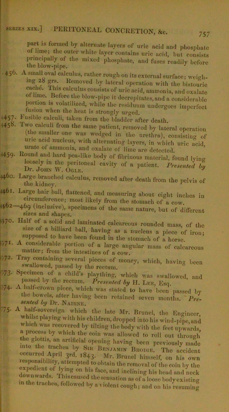 4.56 skkiks xix.] PERITONEAL CONCRETION, &c. ?57 part is formed by alternate layers of uric acid and phosphate of hme; the outer white layer contains uric acid, but consists principally of the mixed phosphate, and fuses readily before the blow-pipe. J A small oval calculus, rather rough on its external surface; weigh- ing, , |f.6: Removed by lateral operation with the bistourie C'r r*0- l)1'!’ca cuius C0Dsiats o(' uric acid, ammonia, and oxalate of lime. Before the blow-pipe it decrepitates,and a considerable portion is volatilized, while the residuum undergoes imperfect fusion when the heat is strongly urged. Fusible calculi, taken from the bladder after death, iwo calculi from the same patient, removed by lateral operation (the smaller one was wedged in the urethra), consisting of unc acid nucleus, with alternating layers, in which uric acid urate of ammonia, and oxalate of lime are detected. . Round and hard pea-like body of fibrinous material, found lying loosely m the peritoneal cavity of a patient. Presented by Ur. John W. Ogle. y Large branched calculus, removed after death from the pelvis of the kidney. Large hair ball, flattened, anil measuring about eight inches in circumference; most likely from the stomach of a cow. —409 (inclusive), specimens of the same nature, but of different sizes and shapes. Halt of a solid and laminated calcareous rounded mass, of the size of a bilhard ball, having as a nucleus a piece of iron- supposed to have been found in the stomach of a horse. A considerable portion of a large angular mass of calcareous matter; from the intestines of a cow. Tray containing several pieces of money, which, havino been swallowed, passed by the rectum. Specimen of a child’s plaything, which was swallowed, and passed by the rectum. Presented by II. Lee, Esq. A half-crown piece, which was stated to have been passed by the bowels, after having been retained seven months. ~ Pre- sented by Dr. Nairnk. A half-sovereign which the late Mr. Brunei, the Engineer, whilst playing with his children, dropped into his wind-pipe,and which was recovered by tilting the body with the feet upwards, a process by which the coin was allowed to roll out through ie glott.s an artificial opening having been previously made occnri J rr S7 o,U Brnjamin Bkoiue. The accident occurred April 3rd. 1843. Mr. Brunei himself, on his own 27 1 n 1,\dt0°btain the removal of the coin by the l [ f Rn . ° r|? m 011 ^ice, and inclining his head and neck downwards. Th.scaused thesensation as of a loose body existing n the trachea, followed by a violent cough; and on his resuming -457 -45^ 459 4460 4461. 462- 470. L71- v.72. 73- 74- 75-