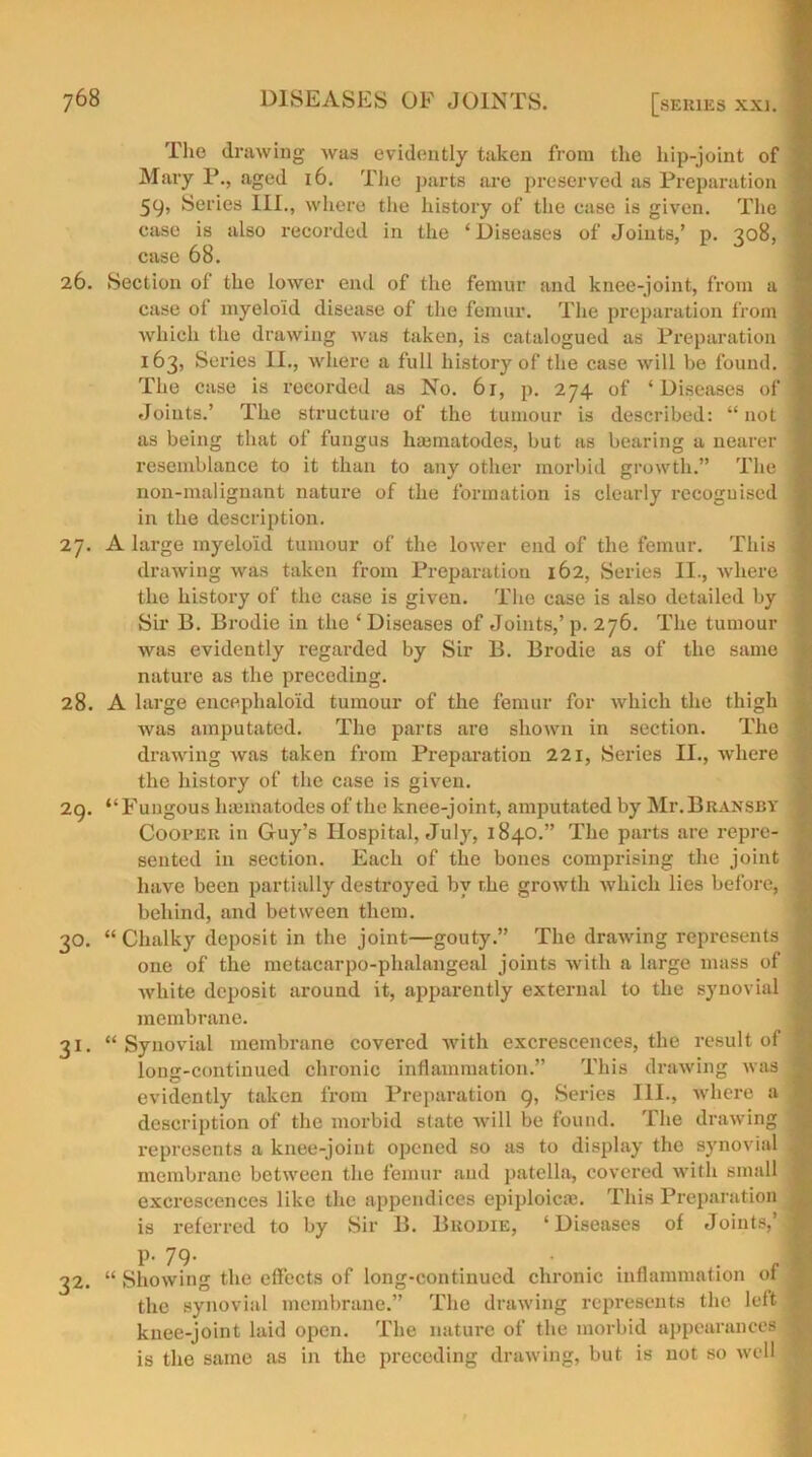 The drawing was evidently taken from the hip-joint of Mary P., aged 16. The parts are preserved as Preparation 1 59, Series III., where the history of the ease is given. The j case is also recorded in the ‘ Diseases of Joints,’ p. 308, ) case 68. 26. Section of the lower end of the femur and knee-joint, from a \ case of myeloid disease of the femur. The preparation from I which the drawing was taken, is catalogued as Preparation 1 163, Series II., where a full history of the case will be found, j The case is recorded as No. 6r, p. 274 of ‘Diseases of j Joints.’ The structure of the tumour is described: “not 1 as being that of fungus hsematodes, but as bearing a nearer 1 resemblance to it than to any other morbid growth.” The ] non-malignant nature of the formation is clearly recognised ] in the description. 27. A large myeloid tumour of the lower end of the femur. This j drawing was taken from Preparation 162, Series II., where j the history of the case is given. The case is also detailed by : Sir B. Brodie in the ‘Diseases of Joints,’ p. 276. The tumour was evidently regarded by Sir B. Brodie as of the same j nature as the preceding. 28. A large encephalo'id tumour of the femur for which the thigh was amputated. The parts are shown in section. The ! drawing was taken from Preparation 221, Series II., where the history of the case is given. 29. “ Fungous liajmatodes of the knee-joint, amputated by Mr. Bransby Cooper in Guy’s Hospital, July, 1840.” The parts are repre- sented in section. Each of the bones comprising the joint have been partially destroyed by the growth which lies before, behind, and between them. 30. “ Chalky deposit in the joint—gouty.” The drawing represents j one of the metacarpo-phalangeal joints with a large mass of white deposit around it, apparently external to the synovial j membrane. 31. “ Synovial membrane covered with excrescences, the result of j long-continued chronic inflammation.” This drawing was j evidently taken from Preparation 9, Series III., where a | description of the morbid state will be found. The drawing ? represents a knee-joint opened so as to display the synovial ^ membrane between the femur and patella, covered with small j excrescences like the appendices epiploic®. This Preparation t is referred to by Sir B. Brodie, ‘Diseases of Joints,’! 32. “ Showing the effects of long-continued chronic inflammation of 1 the synovial membrane.” The drawing represents the left | knee-joint laid open. The nature of the morbid appearances 1 is the same as in the preceding drawing, but is not so well 1