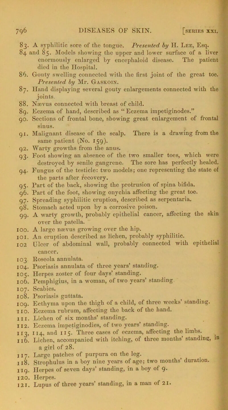 83. A syphilitic sore of the tongue. Presented by H. Lee, Esq. 84. and 85- Models showing the upper and lower surface of a liver enormously enlarged by encephaloid disease. The patient died in the Hospital. 86. Gouty swelling connected with the first joint of the great toe. Presented by Mr. Gaskoin. 87. Hand displaying several gouty enlargements connected with the joints. 88. Nmvus connected with breast of child. 89. Eczema of hand, described as “ Eczema impetiginodes.” 90. Sections of frontal bone, showing great enlargement of frontal sinus. g 1. Malignant disease of the scalp. There is a drawing from the same patient (No. 159). 92. Warty growths from the anus. 93. Foot showing an absence of the two smaller toes, which were destroyed by senile gangrene. The sore has perfectly healed. 94. Fungus of the testicle: two models; one representing the state of the parts after recovery. 95. Part of the back, showing the protrusion of spina bifida. 96. Part of the foot, showing onychia affecting the great toe. 97. Spreading syphilitic eruption, described as serpentaria. 98. Stomach acted upon by a corrosive poison. 99. A warty growth, probably epithelial cancer, affecting the skin over the patella. 100. A large mevus growing over the hip. 101. An eruption described as lichen, probably syphilitic. 102 Ulcer of abdominal wall, probably connected with epithelial cancer. 103 Roseola annulata. 104. Psoriasis annulata of three years’ standing. 105. Herpes zoster of four days’ standing. 106. Pemphigius, in a woman, of two years’ standing 107. Scabies. 108. Psoriasis guttata. 109. Ecthyma upon the thigh of a child, of three weeks’ standing. 110. Eczema rubrum, affecting the back of the hand. 111. Lichen of six months’ standing. 112. Eczema impetiginodies, of two years’ standing. 113. 114, and 115. Three cases of eczema, affecting the limbs. 116. Lichen, accompanied with itching, of three months’ standing, in J a girl of 28. 117. Large patches of purpura on the leg. 118. Strophulus in a boy nine years of age; two months’ duration. 119. Herpes of seven days’ standing, in a boy of 9. 120. Herpes. 121. Lupus of three years’ standing, in a man of 21.