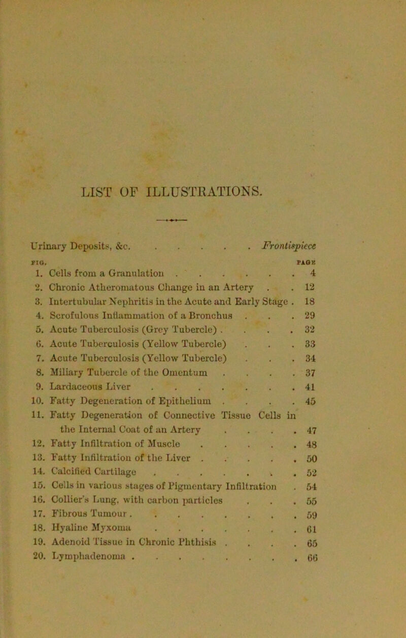 LIST OF ILLUSTRATIONS. Urinary Deposits, &c. Frontispiece no. PACK 1. Cells from a Granulation 4 2. Chronic Atheromatous Change in an Artery . . 12 3. Intertubular Nephritis in the Acute and Early Stage . 18 4. Scrofulous Inflammation of a Bronchus . . .29 5. Acute Tuberculosis (Grey Tubercle) . . . .32 6. Acute Tuberculosis (Yellow Tubercle) . . .33 7. Acute Tuberculosis (Yellow Tubercle) . . .34 8. Miliary Tubercle of the Omentum . . . .37 9. Lardaceous Liver 41 10. Fatty Degeneration of Epithelium . . . .45 11. Fatty Degeneration of Connective Tissue Cells in the Internal Coat of an Artery . . 47 12. Fatty Infiltration of Muscle . . 48 13. Fatty Infiltration of the Liver . . . . 50 14. Calcified Cartilage .... • . 52 15. Cells in various stages of Pigmentary Infiltration . 54 16. Collier’s Lung, with carbon particles , . 55 17. Fibrous Tumour , , . 59 18. Hyaline Myxoma .... . 61 19. Adenoid Tissue in Chronic Phthisis . , . 65 20. Lymphadenoma . . . 66