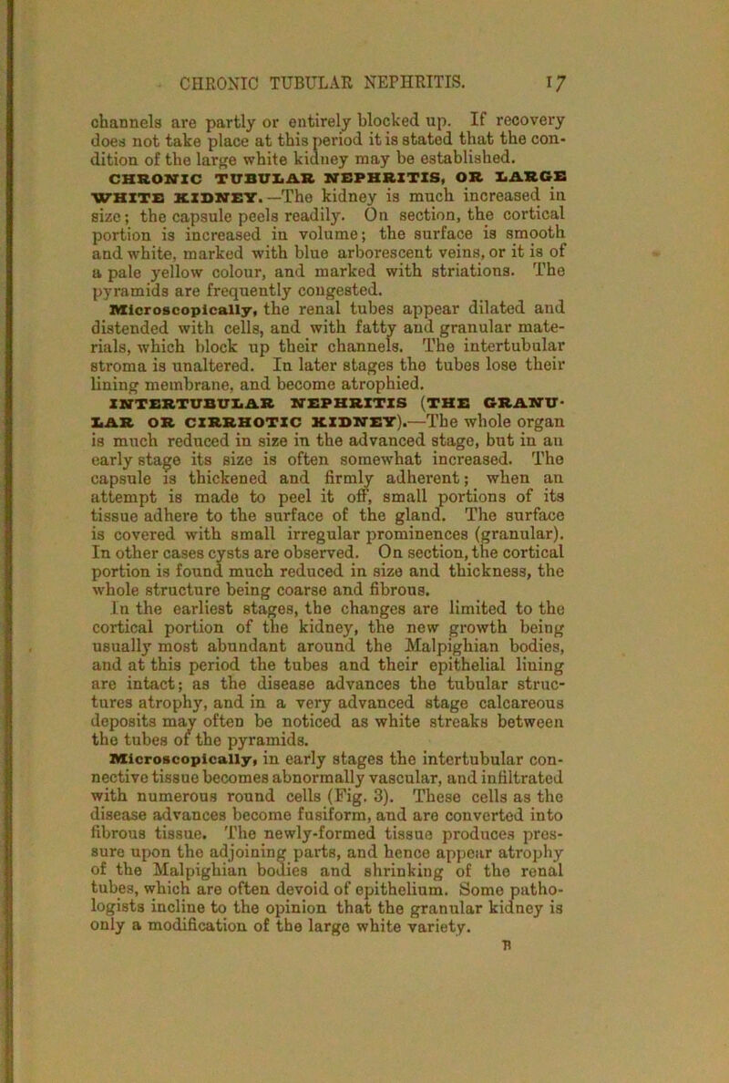 channels are partly or entirely blocked up. II recovery does not take place at this period it is stated that the con- dition of the large white kidney may be established. CHRONIC TUBULAR NEPHRITIS, OR LARGE WHITE kidney.—The kidney is much increased in size; the capsule peels readily. On section, the cortical portion is increased iu volume; the surface is smooth and white, marked with blue arborescent veins, or it is of a pale yellow colour, and marked with striations. The pyramids are frequently congested. Microscopically, the renal tubes appear dilated and distended with cells, and with fatty and granular mate- rials, which block up their channels. The intertubular stroma is unaltered. In later stages the tubes lose their lining membrane, and become atrophied. INTERTUBULAR NEPHRITIS (THE GRANU- LAR OR CIRRHOTIC kidney).—The whole organ is much reduced in size in the advanced stage, but in an early stage its size is often somewhat increased. The capsule is thickened and firmly adherent; when an attempt is made to peel it off, small portions of its tissue adhere to the surface of the gland. The surface is covered with small irregular prominences (granular). In other cases cysts are observed. On section, the cortical portion is found much reduced in size and thickness, the whole structure being coarse and fibrous. In the earliest stages, the changes are limited to the cortical portion of the kidney, the new growth being usually most abundant around the Malpighian bodies, and at this period the tube3 and their epithelial liuing are intact; as the disease advances the tubular struc- tures atrophy, and in a very advanced stage calcareous deposits may often be noticed as white streaks between the tubes of the pyramids. Microscopically, in early stages the intertubular con- nective tissue becomes abnormally vascular, and infiltrated with numerous round cells (Fig. 3). These cells as the disease advances become fusiform, aud are converted into fibrous tissue. The newly-formed tissue produces pres- sure upon the adjoining parts, and hence appear atrophy of the Malpighian bodies and shrinking of the renal tubes, which are often devoid of epithelium. Some patho- logists incline to the opinion that the granular kidney is only a modification of the large white variety.