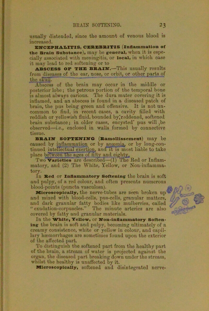 usually distended, since the amount of venous blood is increased. ENCEPHALITIS, CEREBRITIS (inflammation of the Brain Substance), may be general, when it is espe- cially associated with meningitis, or local, in which case it may lead to red softening or to abscess OF the brain.—This usually results from diseases of the ear, nose, or orbit, or other parts of the sicTiTn ABscess of the brain may occur in the middle or posterior lobe; the petrous portion of the temporal bone is almost always carious. The dura mater covering it is inflamed, and an abscess is found in a diseased patch of brain, the pus being green and offensive. It is not un- common to find, in recent cases, a cavity filled with reddish or yellowish fluid, bounded byireddened, softened brain substance; in older cases, encysted' pus will kbe observed—i.e., enclosed in walls formed by connective tissue. BRAIN SOFTENING (Ramollissement) may be caused by inflammation or by anaemia, or by long-con- tinued intelTectualjjxcrtion, and' it Ts most liable to take place beTweeirthe ages of hfty and eighty. Two Varieties are described—(1) The Red or Inflam- matory, and (2) The White, Tellow, or Non-inflamma- tory. In Red or Inflammatory Softening: the brain is soft and pulpy, of a red colour, and often presents numerous blood-points (puncta vasculosa). Microscopically, the nerve-tubes are seen broken up and mixed with blood-cells, pus-cells, granular matters, and dark granular fatty bodies like mulberries, called “ exudation-corpuscles.” The minute arteries are also covered by fatty and granular materials. In the White, Yellow, or Non-inflammatory Soften- ing: the brain is soft and pulpy, becoming ultimately of a creamy consistence, white or yellow in colour, and capil- lary hmmorrhages are sometimes found upon the exterior of the affected part. To distinguish the softened part from the healthy part of the brain, a stream of water is projected against the organ, the diseased part breaking down under the stream, whilst the healthy is unaffected by it. Microscopically, softened and disintegrated nerve-