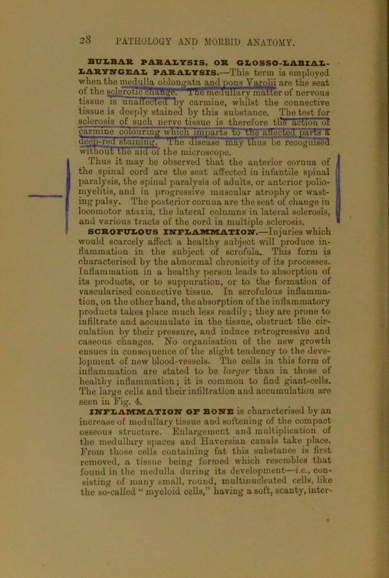 BULBAS PARALYSIS, OR CLOSSO-LABZAL- laryngeal paralysis.—This terra is employed when the medulla oblongata and pons Varolii are the seat of the sclero'lic'cliHflfre. TB6 medullary matter of nervous tissue is unaffected by carmine, wliilst the connective tissue is deeply stained by this substance. The test for sclerosis of such nerve tissue is therefore the action ot '•;tniliue '■uluiu-iiisj which Imparts to tlie affected parts a aeep-red staining.' The disease may thus be recognised without” the aid of the microscope. Thus it may be observed that the anterior cornua of the spinal cord are the seat affected in infantile spinal paralysis, the spinal paralysis of adults, or anterior polio- myelitis, and in progressive muscular atrophy or wast- ing palsy. The posterior cornua are the seat of change in locomotor ataxia, the lateral columns in lateral sclerosis, and various tracts of the cord in multiple sclerosis. scrofulous inflammation.—Injuries which would scarcely affect a healthy subject will produce in- flammation in the subject of scrofula. This form is characterised by the abnormal chronicity of its processes. Inflammation in a healthy person leads to absorption of its products, or to suppuration, or to the formation of vascularised connective tissue. In scrofulous inflamma- tion, on the other hand, the absorption of the inflammatory products takes place much less readily; they are prone to infiltrate and accumulate in the tissue, obstruct the cir- culation by their pressure, and induce retrogressive and caseous changes. No organisation of the new growth ensues in consequence of the slight tendency to the deve- lopment of new blood-vessels. The cells in this form of inflammation are stated to be larger than in those of healthy inflammation; it is common to find giant-cells. The large cells and their infiltration and accumulation are seen in Fig. 4. inflammation OF bons is characterised by an increase of medullary tissue aud softening of the compact osseous structure. Enlargement and multiplication of the medullary spaces and Haversian canals take place. From those cells containing fat this substance is first removed, a tissue being formed which resembles that found in the medulla during its development—i.e., con- sisting of many small, round, inultinucleated cells, like the so-called “ myeloid cells,” having a soft, scanty, inter-