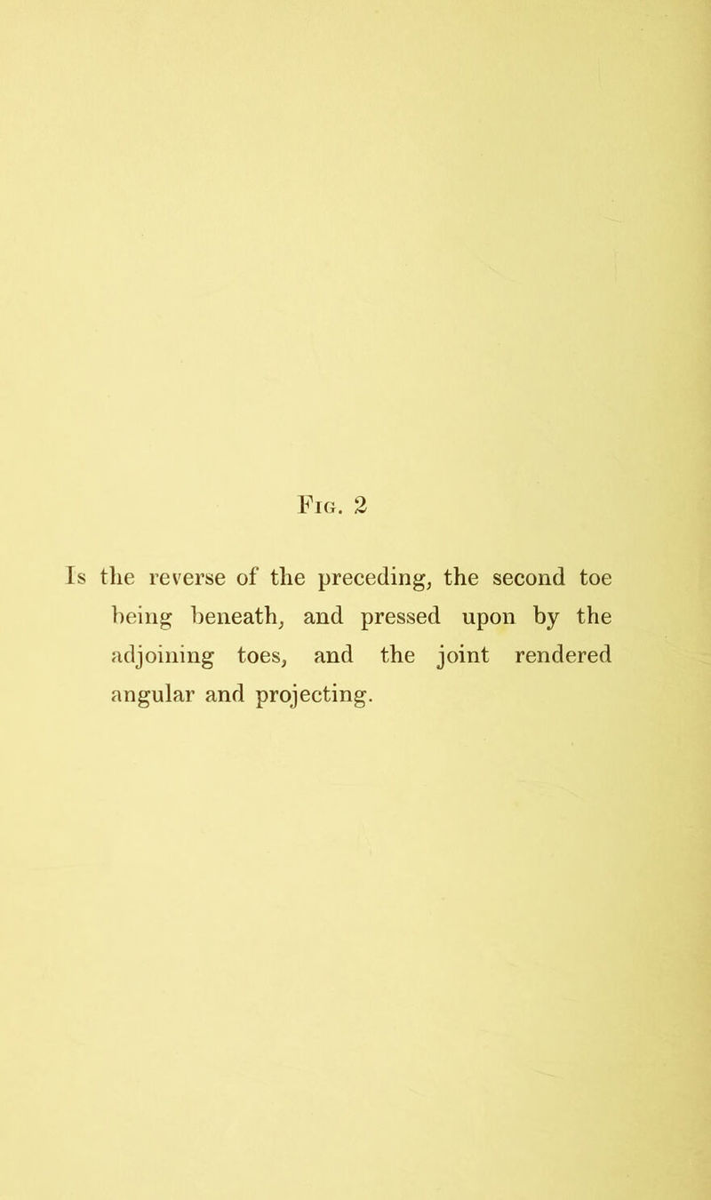 Is the reverse of the preceding^ the second toe being beneath^ and pressed upon by the adjoining toes, and the joint rendered angular and projecting.