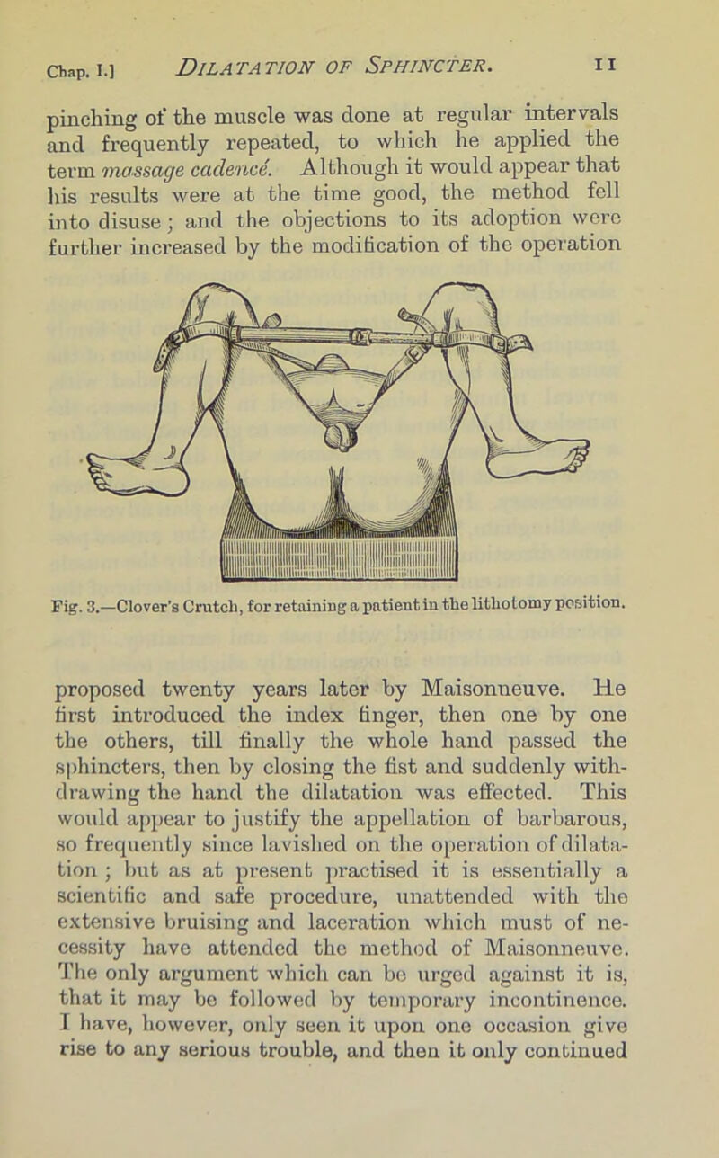 pinching of the muscle was done at regular intervals and frequently repeated, to which he applied the term massage cadence. Although it would appear that his results were at the time good, the method fell into disuse; and the objections to its adoption were further increased by the modification of the operation Fig. 3.—Clover’s Crutch, for retaining a patient in the lithotomy position. proposed twenty years later by Maisonneuve. He first introduced the index finger, then one by one the others, till finally the whole hand passed the sphincters, then by closing the fist and suddenly with- drawing the hand the dilatation was effected. This would appear to justify the appellation of barbarous, so frequently since lavished on the operation of dilata- tion ; but as at present practised it is essentially a scientific and safe procedure, unattended with the extensive bruising and laceration which must of ne- cessity have attended the method of Maisonneuve. The only argument which can be urged against it is, that it may be followed by temporary incontinence. I have, hosvever, only seen it upon one occasion give rise to any serious trouble, and then it only continued