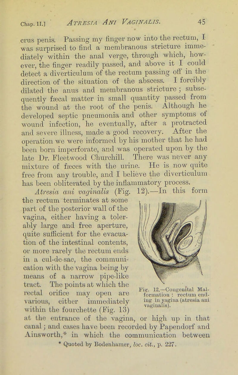 crus penis. Passing my finger now into the rectum, I was surprised to find a membranous stricture imme- diately within the anal verge, through which, how- ever, the finger readily passed, and above it I could detect a diverticulum of the rectum passing off in the direction of the situation of the abscess. I forcibly dilated the anus and membranous stricture ; subse- quently fiecal matter in small quantity passed from the wound at the root of the penis. Although he developed septic pneumonia and other symptoms of wound infection, he eventually, after a protracted and severe illness, made a good recovery. After the operation we were informed by his mother that he had been born imperforate, and was operated upon by the late Dr. Fleetwood Churchill. There was never any mixture of fteces with the urine. He is now quite free from any trouble, and I believe the diverticulum has been obliterated by the inflammatory process. Atresia ani vaginalis (Fig. 12).-—In this form the rectum terminates at some part of the posterior wall of the vagina, either having a toler- ably large and free aperture, quite sufficient for the evacua- tion of the intestinal contents, or more rarely the rectum ends in a cul-de-sac, the communi- cation with the vagina being by means of a narrow pipe-like tract. The points at which the rectal orifice may open are various, either immediately within the fourchette (Fig. 13) at the entrance of the vagina, or high up in that canal; and cases have been recorded by Papendorf and Ainsworth,* in which the communication between * Quoted by Bodenhamor, loc. cit., p. 227. Fig. 12.—Congenital Mal- formation : rectum end- ing in yngimi (atresia ani vaginalis).