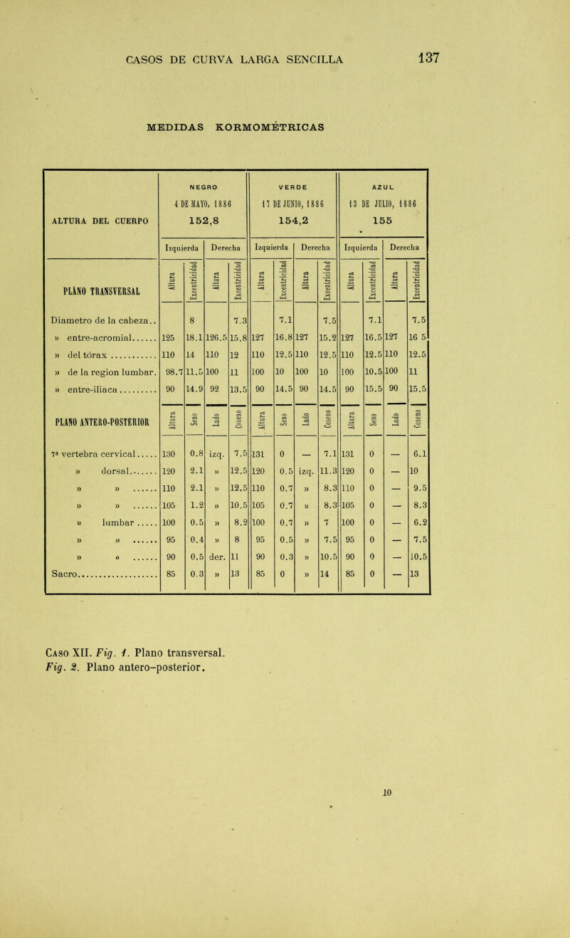 MEDIDAS KORMOMÉTRICAS ALTURA DEL CUERPO N EGRO 4 DE MAYO, 1886 152,8 VERDE n DE JUNIO, 1886 154,2 13 AZUL )E JDLIO, 1886 155 | Izquierda Derecha Izquierda Derecha Izquierda Derecha cd c-3 -o cd od od ce od cd c3 cd :g od *c3 «3 *C3 cd =3 C3 PLANO TRANSVERSAL C=3 03 C3 X w 03 X s=a 03 03 X w c= 03 C3 X S= 03 C3 X C=3 S 03 X Diámetro de la cabeza.. 8 7.3 7.1 7.5 7.1 7.5 » entre-acromial 125 18.1 126.5 15.8 127 16.8 127 15.2 127 16.5 127 16 5 » del tórax 110 14 110 12 110 12.5 110 12.5 110 12.5 110 12.5 » de la región lumbar. 98.7 11.5 100 11 100 10 100 10 100 10.5 100 11 » entre-iliaca 90 14.9 92 13.5 90 14.5 90 14.5 90 15.5 90 15.5 cd c=> <o s= cd o o> ¡= ce <=> ea PLANO ANTERO-POSTERIOR 03 C/O cd 03 ® c^> 03 C/3 cd i—3 C_3 03 on ce >—3 C/3 ® C_3 7» vertebra cervical 130 0.8 izq. 7.5 131 0 — 7.1 131 0 — 6.1 » dorsal. 120 2.1 )) 12.5 120 0.5 izq. 11.3 120 0 — 10 » » 110 2.1 )) 12.5 110 0.7 » 8.3 110 0 — 9.5 » » 105 1.2 » 10.5 105 0.7 )) 8.3 105 0 — 8.3 » lumbar 100 0.5 » 8.2 100 0.7 » 7 100 0 — 6.2 » » 95 0.4 )) 8 95 0.5 » 7.5 95 0 — 7.5 » o 90 0.5 der. 11 90 0.3 10.5 90 0 — 10.5 Sacro 85 0.3 » 13 85 0 » 14 85 0 — 13 Caso XII. Fig. 1. Plano transversal. Fig. Plano antero-posterior. 10