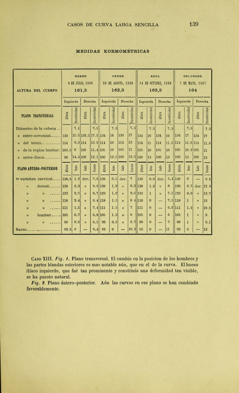 MEDIDAS KORMOMÉTRICAS ALTURA DEL CUERPO N EGRO 6 DE JULIO, 1886 161,5 VERDE 20 DE AGOSTO, i886 162,3 AZUL i4 DE OCTUBRE, 1886 163,5 COLORADO 7 DE MAYO, 1887 164 Izquierda Derecha Izquierda Derecha Izquierda Derecha Izquierda Derecha ”53 j ”53 ”53 ”35 cd -a cd cd -rs cd ”33 cd cd ”53 cd ”53 cd PLANO TRANSVERSAL <rd S-. =3 «as cd «as cd cd =3 ^•as s=s cd C—< =3 as cd es cd «as cd «as «as «as -*3 «as «as ^*5 «as «as «as —«í 2 «as —*3 os «as —a «as w X X >«í X CLU X Diámetro de la cabeza .. 7.1 7.5 7.3 7.3 7.3 7.3 7.3 7.3 » entre-acromial 133 15.5 132.5 17.5 134 16 133 17 134 16 134 16 134 17 134 17 » del tórax 114 9.3 114 13.2 114 10 114 13 114 11 114 11.5 114 11.6 114 11.6 » de la región lumbar. 103.5 9 ' 105 11.4 105 10 105 11 105 10 105 10 105 10.2 105 11 » entre-iliaca 98 14.4 100 12.1 100 12.5 100 12.5 100 13 100 13 100 13 100 13 PLANO ANTERO-POSTERIOR cd e— <=> «as <=> -o cd <=> es «as oo <o cd *-« «o es os o> ”3J ed <=> s= ■as •o cd «o «as «o ”53 cd «o «as <=> cd c— C3 es «o cd o es «as c/a c^s c_s -*í 5^S 7a vertebra cervical 138.5 1.2 der. 7.2 139 0.5 der. 7 139 0.8 der. 5.4 139 0 — 9.5 » dorsal 128 2.3 » 9.3 128 1.2 » 9.3 128 1.2 )> 8 128 0.7 der. 12 3 » » 123 2.7 » 9.7 123 1.2 » 9.6 123 1 )) 7.5 123 0.9 )) 12.7 » » 118 2.4 » 9.4 118 1.5 » 8 4 118 0 — 7.5 118 1 » 12 W )) 111 1.5 )) 7.4 111 1.5 >) 7 111 0 6.2 111 1.2 )) 10 5 » lumbar 105 0.7 )) 6.8 105 1.3 )) 6 105 0 6 105 1 )) 9 » » 99 0.6 » 6.5 99 0.5 » 6.7 99 0 — 7 99 1 )> 9.1 Sacro 92.5 0 — 9.4 92 0 — 10.3 92 0 — 11 92 0 — 12 Caso XIII. Fig. 1. Plano transversal. El cambio en la posición de los hombros y las partes blandas esteriores es mas notable aún, que en el de la curva. El hueso ilíaco izquierdo, que fué tan prominente y constituia una deformidad tan visible, se ha puesto natural. Fig. 2. Plano áutero-posterior. Aún las curvas en ese plano se han cambiado favorablemente.