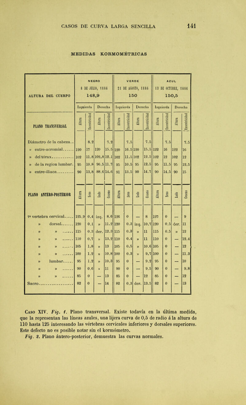 MEDIDAS KORMOMÉTRICAS ALTURA DEL CUERPO N EGRO 8 DE JULIO, 1886 148,9 21 VERDE )E AGOSTO, 1886 150 13 D AZUL E OCTUBRE, 1886 150,5 ; Izquierda Derecha Izquierda Derecha Izquierda Derecha PLANO TRANSVERSAL Diámetro de la cabeza.. » entre-acromial » del tórax » de la región lumbar. » entre-iliaca PLANO ANTERO-POSTERIOR cd P-4 —=3 cd rJ *3 ES <33 C3 X u 8.2 17 11.8 10.8 13.8 cd cd ’3 ES <33 c3 X w cd -o cd C3 es <33 X cd T3 cd [3 C3 X cd -T3 cd *3 03 <r> X cd ea cd ’3 es <33 C3 X Cae] 7.5 16 12 12.5 15 120 102 95 90 120 102.8 96.5 88.6 7.2 15.5 12.1 11.7 14.6 120 102 95 91 7.5 16.5 11.5 10.5 13.5 120 102 95 90 7.5 15.5 12.5 12.5 14.7 122 102 95 90 7.5 16 12 11.5 14.5 122 102 95 90 cd sd er- es <3J -o ►—a <T> J=3 05 C/3 O ©3 E3 <o <33 C/Q <T> cd o es «33 en O cd C-. E=3 <o es <33 <T> ^r» cd <T> ES 7a vertebra cervical 125.9 0.4 izq. 8.6 126 0 8 127 0 9 » dorsal 120 0.1 » 11.2 120 0.3 izq. 10.7 120 0.5 der. 11 » » 115 0.3 der. 12.3 115 0.3 » 11 115 0.5 » 12 » » 110 0.7 » 13.2 110 0.4 » 11 110 0 — 12.4 » » .. 105 1.8 13 105 0.5 » 10.6 105 0 — 12 » » 100 1.2 10.8 100 0.3 » 9.7 100 0 — 11.3 » lumbar 95 1.2 » 10.3 95 0 — 9.2 95 0 — 10 » » 90 0.6 )) 11 90 0 — 9.5 90 0 — 9.8 » » 85 0 — 13 85 0 — 12 85 0 — 12 Sacro 82 0 — 14 82 0.3 der. 13.5 82 0 — 13 Caso XIV. Fig. 7. Plano transversal. Existe todavía en la última medida, que la representan las líneas azules, una lijera curva de 0,5 de radio á la altura de 110 hasta 125 interesando las vértebras cervicales inferiores y dorsales superiores. Este defecto no es posible notar sin el kormómetro. Fig. 2. Plano ántero-posterior, demuestra las curvas normales.