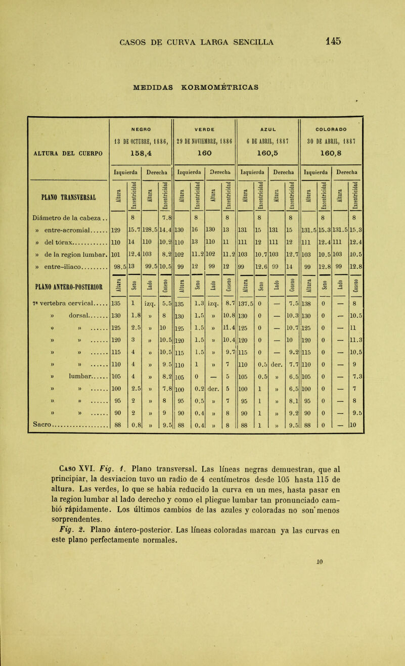 MEDIDAS KORMOMÉTRICAS ALTURA DEL CUERPO 13 DI N EGRO OCTUBRE, 1 886, 158,4 VERDE 29 DE NOVIEMBRE, 1886 160 AZUL 6 DE ABRIL, 1881 160,5 COLORADO 30 DE ABRIL, 1881 j 160,8 Izquierda Derecha Izquierda Derecha Izquierda Derecha Izquierda Derecha ”T=3 Cd -o cd cd -o cd «3 -o cd -cd cd -üd cd cd ’ca cd cd *3 e3 ed ca cd ca cd C_> cd ca PLANO TRANSVERSAL C3 (=3 05 c— -t—* J= cJ ca ca ca ca ca ca ca ca ca -< ca ca cd X X X X ca X ca X ca X w ca X w Diámetro de la cabeza .. 8 7.8 8 8 8 8 8 8 » entre-acromial 129 15.7 128.5 14.4 130 16 130 13 131 15 131 15 131.5 15.3 131.5 15.3 » del tórax 110 14 110 10.2 110 13 110 11 111 12 111 12 111 12.4 111 12.4 » de la región lumbar. 101 12.4 103 8.2 102 11.2 102 11.2 103 10.7 103 12.7 103 10.5 103 10.5 » entre-iliaco 98.5 13 99.5 10.5 99 12 99 12 99 12.6 99 14 99 12.8 99 12.8 PLANO ANTERO-POSTERIOR cd t-4 S» <=> ca 02 <o cd <=> ca ca C/2 «3 Cd o ca o eso <o loseno cd ca •o ca a? <=> cd o> ca <aa <o cd o ca <x> DO <=> -o cd —a o> ca ca -aS -Ü -< 7a vertebra cervical 135 1 izq. 5.5 135 1.3 izq. 8.7 137.5 0 — 7.5 138 0 — 8 » dorsal 130 1.8 )) 8 130 1.5 » 10.8 130 0 — 10.3 130 0 — 10.5 0 » 125 2.5 )> 10 125 1.5 » 11.4 125 0 — 10.7 125 0 — 11 » » 120 3 » 10.5 120 1.5 » 10.4 120 0 — 10 120 0 — 11.3 » » 115 4 » 10.5 115 1.5 » 9.7 115 0 — 9.2 115 0 — 10.5 » » 110 4 » 9.5 110 1 » 7 110 0.5 der. 7.7 110 0 — 9 » lumbar 105 4 » 8.2 105 0 — 5 105 0.5 » 6.5 105 0 — 7.3 ! » » 100 2.5 )) 7.8 100 0.2 der. 5 100 1 » 6.5 100 0 — 7 ! » » 95 2 » 8 95 0.5 )) 7 95 1 )) 8.1 95 0 — 8 » » 90 2 » 9 90 0.4 » 8 90 1 » 9.2 90 0 — 9.5 Sacro 88 0.8 » 9.5 88 0.4 » 8 88 1 )) 9.5 88 0 — 10 Caso XVI. Fig. i. Plano transversal. Las líneas negras demuestran, que al principiar, la desviación tuvo un radio de 4 centímetros desde 105 hasta 115 de altura. Las verdes, lo que se había reducido la curva en un mes, hasta pasar en la región lumbar al lado derecho y como el pliegue lumbar tan pronunciado cam- bió rápidamente. Los últimos cambios de las azules y coloradas no son'menos sorprendentes. Fig. 2. Plano ántero-posterior. Las líneas coloradas marcan ya las curvas en este plano perfectamente normales. 10