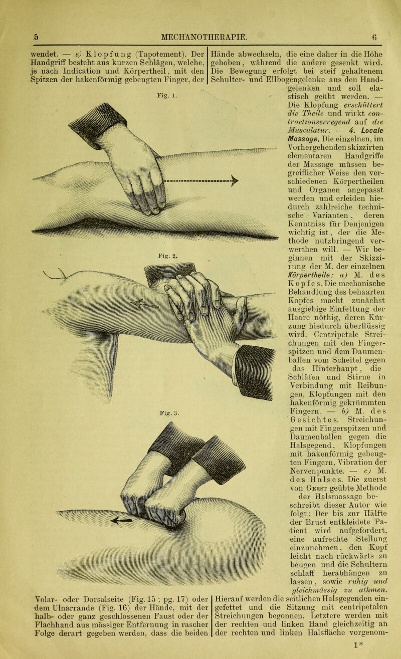wendet. — e) Klopfung (Tapotement). Der Handgriff bestellt aus kurzen Schlägen, welche, je nach Indication und Körpertheil, mit den Spitzen der hakenförmig gebeugten Finger, der Fig. 1. Fig. 2. Fig. Volar- oder Dorsalseite (Fig. 15 ; pg. 17) oder dem Ulnarrande (Fig. 16) der Hände, mit der halb- oder ganz geschlossenen Faust oder der Flachhand aus mässiger Entfernung in rascher Folge derart gegeben werden, dass die beiden Hände abwechseln, die eine daher in die Höhe gehoben, während die andere gesenkt wird. Die Bewegung erfolgt bei steif gehaltenem Schulter- und Ellbogengelenke aus den Hand- gelenken und soll ela- stisch geübt werden. — Die Klopfung erschüttert die Theile und wirkt con- tractionserregend auf die Musculatur. — 4. Locale Massage. Die einzelnen, im Vorhergehenden skizzirten elementaren Handgriffe der Massage müssen be- greiflicher Weise den ver- schiedenen Körpertheilen und Organen angepasst werden und erleiden hie- durch zahlreiche techni- sche Varianten , deren Kenntniss für Denjenigen wichtig ist, der die Me- thode nutzbringend ver- werthen will. — Wir be- ginnen mit der Skizzi- rung der M. der einzelnen KörpertheHe: a) M. des Kop fe s. Die mechanische Behandlung des behaarten Kopfes macht zunächst ausgiebige Einfettung der Haare nöthig, deren Kür- zung hiedurch überflüssig wird. Centripetale Strei- chungen mit den Finger- spitzen und dem Daumen- ballen vom Scheitel gegen das Hinterhaupt , die Schläfen und Stirne in Verbindung mit Reibun- gen, Klopfungen mit den hakenförmig gekrümmten Fingern. — b) M. des Gesichtes. Streichun- gen mit Fingerspitzen und Daumenballen gegen die Halsgegend, Klopfungen mit hakenförmig gebeug- ten Fingern, Vibration der Nervenpunkte. -— c) M. des Halses. Die zuerst von Gehst geübte Methode der Halsmassage be- schreibt dieser Autor wie folgt: Der bis zur Hälfte der Brust entkleidete Pa- tient wird aufgefordert, eine aufrechte Stellung einzunehmen, den Kopf leicht nach rückwärts zu beugen und die Schultern schlaff herabhängen zu lassen, sowie ruhig und gleichmässig zu athmen. Hierauf werden die seitlichen Halsgegenden ein- gefettet und die Sitzung mit centripetalen Streichungen begonnen. Letztere werden mit der rechten und linken Hand gleichzeitig an der rechten und linken Halsfläche vorgenom- 1*