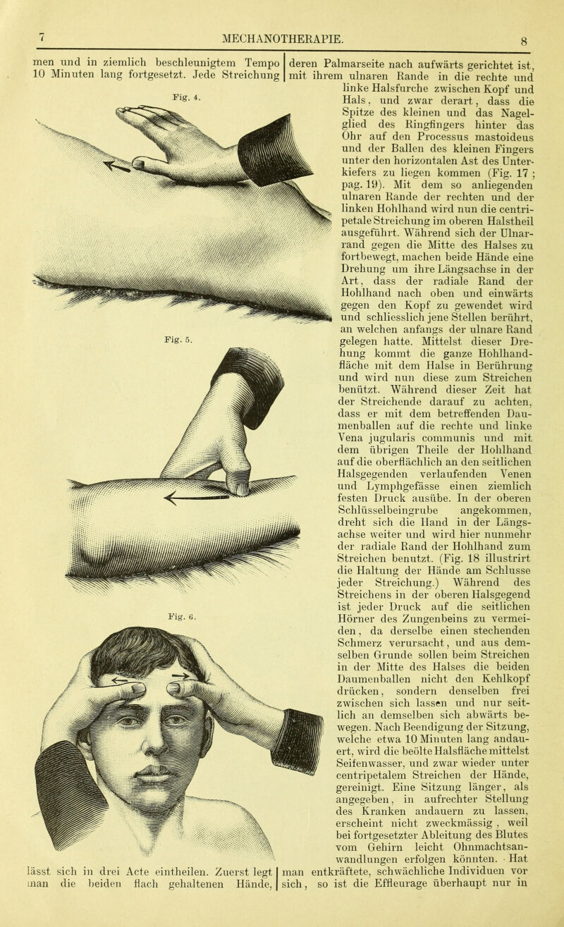 8 men und in ziemlich beschleunigtem Tempo 10 Minuten lang fortgesetzt. Jede Streichung Fig. 4. Fig. 5. Fig. 6. lässt sich in drei Acte eintheilen. Zuerst legt man die beiden flach gehaltenen Hände, deren Palmarseite nach aufwärts gerichtet ist, mit ihrem ulnaren Rande in die rechte und linke Halsfurche zwischen Kopf und Hals, und zwar derart, dass die Spitze des kleinen und das Nagel- glied des Ringfingers hinter das Ohr auf den Processus mastoideus und der Ballen des kleinen Fingers unter den horizontalen Ast des Unter- kiefers zu liegen kommen (Fig. 17 ; pag. 19). Mit dem so anliegenden ulnaren Rande der rechten und der linken Hohlhand wird nun die centri- petale Streichung im oberen Halstheil ausgeführt. Während sich der Ulnar- rand gegen die Mitte des Halses zu fortbewegt, machen beide Hände eine Drehung um ihre Längsachse in der Art, dass der radiale Rand der Hohlhand nach oben und einwärts gegen den Kopf zu gewendet wird und schliesslich jene Stellen berührt, an welchen anfangs der ulnare Rand gelegen hatte. Mittelst dieser Dre- hung kommt die ganze Hohlhand- fläche mit dem Halse in Berührung und wird nun diese zum Streichen benützt. Während dieser Zeit hat der Streichende darauf zu achten, dass er mit dem betreffenden Dau- menballen auf die rechte und linke Vena jugularis communis und mit dem übrigen Theile der Hohlhand auf die oberflächlich an den seitlichen Halsgegenden verlaufenden Venen und Lymphgefässe einen ziemlich festen Druck ausübe. In der oberen Schlüsselbeingrube angekommen, dreht sich die Hand in der Längs- achse weiter und wird hier nunmehr der radiale Rand der Hohlhand zum Streichen benutzt. (Fig. 18 illustrirt die Haltung der Hände am Schlüsse jeder Streichung.) Während des Streichens in der oberen Halsgegend ist jeder Druck auf die seitlichen Hörner des Zungenbeins zu vermei- den , da derselbe einen stechenden Schmerz verursacht, und aus dem- selben Grunde sollen beim Streichen in der Mitte des Halses die beiden Daumenballen nicht den Kehlkopf drücken, sondern denselben frei zwischen sich lassen und nur seit- lich an demselben sich abwärts be- wegen. Nach Beendigung der Sitzung, welche etwa 10 Minuten lang andau- ert, wird die beölte Halsfläche mittelst Seifenwasser, und zwar wieder unter centripetalem Streichen der Hände, gereinigt. Eine Sitzung länger, als angegeben, in aufrechter Stellung des Kranken andauern zu lassen, erscheint nicht zweckmässig , weil bei fortgesetzter Ableitung des Blutes vom Gehirn leicht Ohnmachtsan- wandlungen erfolgen könnten. Hat man entkräftete, schwächliche Individuen vor sich, so ist die Effleurage überhaupt nur in