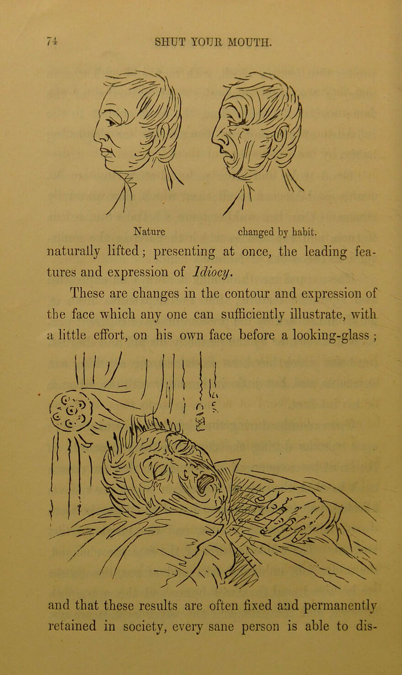 Nature clianged by habit, naturally lifted; presenting at once, the leading fea- tures and expression of Idiocy. These are changes in the contour and expression of the face which any one can sufficiently illustrate, with a little effort, on his own face before a looking-glass ; and that these results are often fixed and permanently retained in society, every sane person is able to dis-