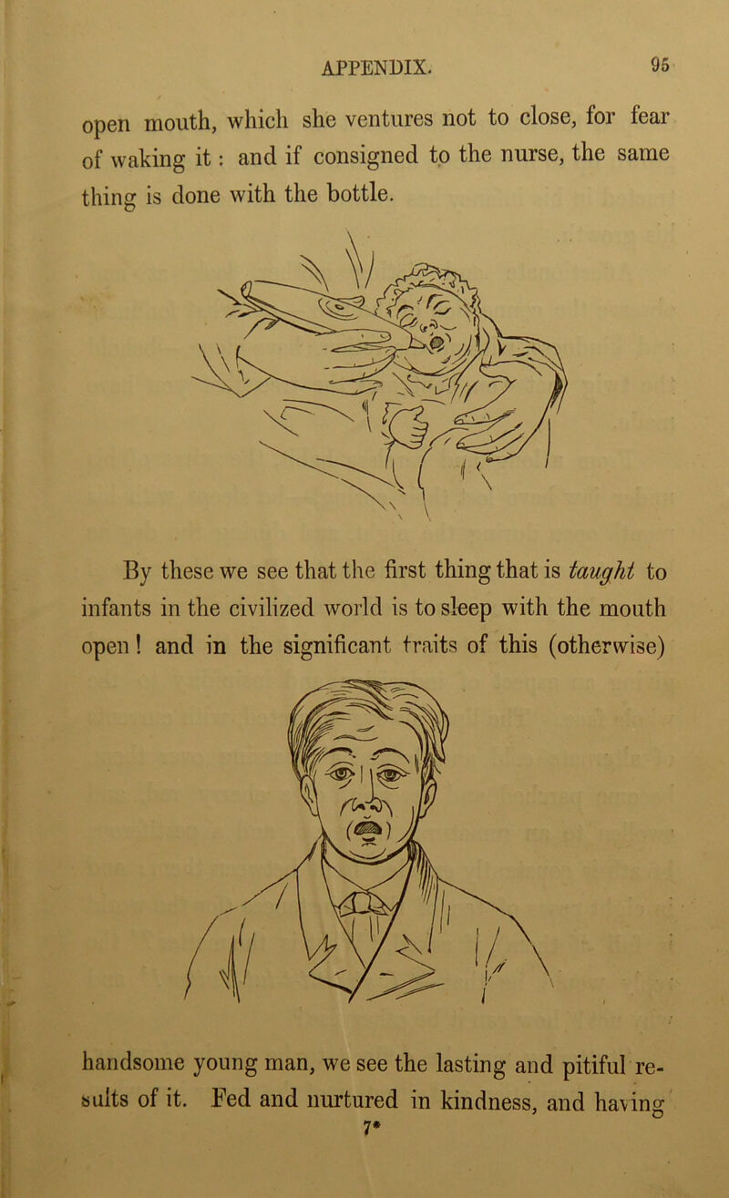 By these we see that the first thing that is taught to infants in the civilized world is to sleep with the mouth open! and in the significant traits of this (otherwise) handsome young man, we see the lasting and pitiful re- sults of it. Fed and nurtured in kindness, and having 7* open mouth, which she ventures not to close, for fear of waking it: and if consigned to the nurse, the same thing is done with the bottle.