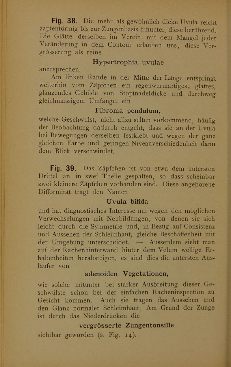 Fig. 38. Die mehr als gewöhnlich dicke Uvula reicht zapfenförmig bis zur Zungenbasis hinunter, diese berührend. Die Glätte derselben im Verein mit dem Mangel jeder Veränderung in dem Contour erlauben uns, diese Ver- grösserung als reine Hypertrophia uvulae anzusprechen. Am linken Rande in der Mitte der Länge entspringt weiterhin vom Zäpfchen ein regenwurmartiges, glattes, glänzendes Gebilde von Stopfnadeldicke und durchweg gleichmässigem Umfange, ein Fibroma pendulum, welche Geschwulst, nicht allzu selten vorkommend, häufig der Beobachtung dadurch entgeht, dass sie an der Uvula bei Bewegungen derselben festklebt und wegen der ganz gleichen Farbe und geringen Niveauverschiedenheit dann dem Blick verschwindet. Fig. 39. Das Zäpfchen ist von etwa dem untersten Drittel an in zwei Theile gespalten, so dass scheinbar zwei kleinere Zäpfchen vorhanden sind. Diese angeborene Difformität trägt den Namen Uvula bifida und hat diagnostisches Interesse nur wegen den möglichen Verwechselungen mit Neubildungen, von denen sie sich leicht durch die Symmetrie und, in Bezug auf Consistenz und Aussehen der Schleimhaut, gleiche Beschaffenheit mit der Umgebung unterscheidet. — Ausserdem sieht man auf der Rachenhinterwand hinter dem Velum wellige Er- habenheiten herabsteigen, es sind dies die untersten Aus- läufer von adenoiden Vegetationen, wie solche mitunter bei starker Ausbreitung dieser Ge- schwülste schon bei der einfachen Racheninspection zu Gesicht kommen. Auch sie tragen das Aussehen und den Glanz normaler Schleimhaut. Am Grund der Zunge ist durch das Niederdrücken die vergrösserte Zungentonsille sichtbar geworden (s. Fig. 14).