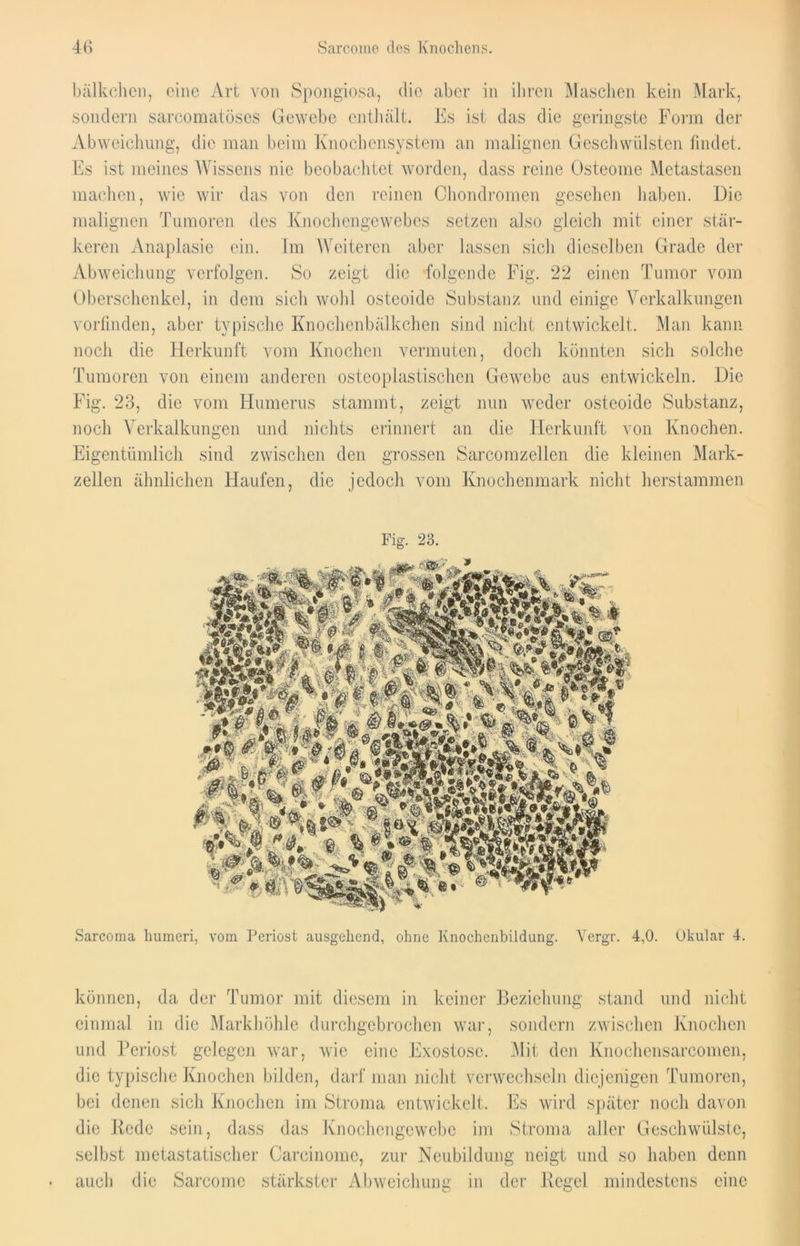 4(1 Sarcorae des Knochens. bälkchen, eine Art von Spongiosa, die aber in ihren Maschen kein Mark, sondern sarcomatöses Gewebe enthält. Es ist das die geringste Form der Abweichung, die man beim Knochensystem an malignen Geschwülsten findet. Es ist meines Wissens nie beobachtet worden, dass reine Osteome Metastasen machen, wie wir das von den reinen Chondromen gesehen haben. Die malignen Tumoren des Knochengewebes setzen also gleich mit einer stär- keren Anaplasie ein. Im Weiteren aber lassen sich dieselben Grade der Abweichung verfolgen. So zeigt die folgende Fig. 22 einen Tumor vom Oberschenkel, in dem sicli wohl osteoide Substanz und einige Verkalkungen vorfinden, aber typische Knochenbälkchen sind nicht entwickelt. Man kann noch die Herkunft vom Knochen vermuten, doch könnten sich solche Tumoren von einem anderen osteoplastischen Gewebe aus entwickeln. Die Fig. 23, die vom Humerus stammt, zeigt nun weder osteoide Substanz, noch Verkalkungen und nichts erinnert an die Herkunft von Knochen. Eigentümlich sind zwischen den grossen Sarcomzellen die kleinen Mark- zellen ähnlichen Haufen, die jedoch vom Knochenmark nicht herstammen Fig. 23. Sarcoma humeri, vom Periost ausgehend, ohne Knochenbildung. Vergr. 4,0. Okular 4. können, da der Tumor mit diesem in keiner Beziehung stand und nicht einmal in die Markhöhle durch gebrochen war, sondern zwischen Knochen und Periost gelegen war, wie eine Exostose. Mit den Knoehensarcomen, die typische Knochen bilden, darf man nicht verwechseln diejenigen Tumoren, bei denen sich Knochen im Stroma entwickelt. Es wird später noch davon die Rede sein, dass das Knochengewebe im Stroma aller Geschwülste, selbst metastatischer Carcinomc, zur Neubildung neigt und so haben denn auch die Sarcome stärkster Abweichung in der Regel mindestens eine