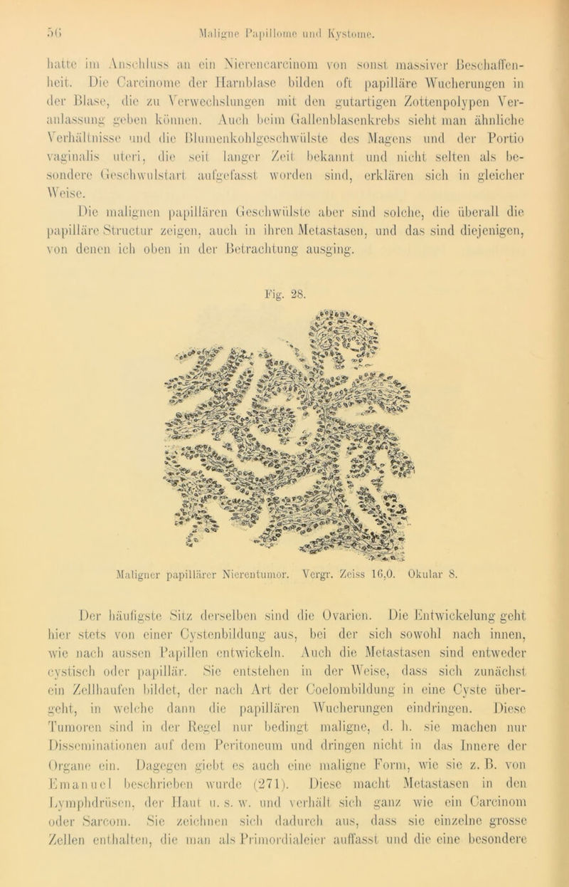 Maligne Papillome und Kystome. ä (i im Anschluss an ein Nierenearcinom von sonst massiver ßeschaffen- lieit. Die Carcinome der Harnblase bilden oft papilläre Wucherungen in der Blase, die zu \ erwechslungen mit den gutartigen Zottenpolypen Ver- anlassung geben können. Auch beim Gallenblasenkrebs sieht man ähnliche \ erhültnisse und die Blumenkohlgeschwülste des Magens und der Portio vaginalis uteri, die seit langer Zeit bekannt und nicht seiten als be- sondere Geschwnlstarl aufgefasst worden sind, erklären sich in gleicher Weise. Die malignen papillären Geschwülste aber sind solche, die überall die papilläre Structur zeigen, auch in ihren Metastasen, und das sind diejenigen, von denen ich oben in der Betrachtung ausging. %. 28. Maligner papillärer Nierentumor. Vcrgr. Zeiss 16.0. Okular 8. Der häufigste Sitz derselben sind die Ovarien. Die Entwickelung geht hier stets von einer Cystenbildung aus, bei der sich sowohl nach innen, wie nach aussen Papillen entwickeln. Auch die Metastasen sind entweder cystisch oder papillär. Sie entstehen in der Weise, dass sich zunächst ein Zellhaufen bildet, der nach Art der Coelombildung in eine Cyste über- geht, in welche dann die papillären Wucherungen eindringen. Tumoren sind in der Regel nur bedingt maligne, d. h. sie machen nur Disseminationen auf dem Peritoneum und dringen nicht in das Innere der Organe ein. Dagegen giebt es auch eine maligne Form, wie sie z. B. von Emanucl beschrieben wurde (271). Diese macht Metastasen in den Lymphdriisen, der Haut u. s. w. und verhält sich ganz wie ein Carcinom oder Sarcom. Sie zeichnen sich dadurch aus, dass sie einzelne grosse Zellen enthalten, die man als Primordialeier auffasst und die eine besondere