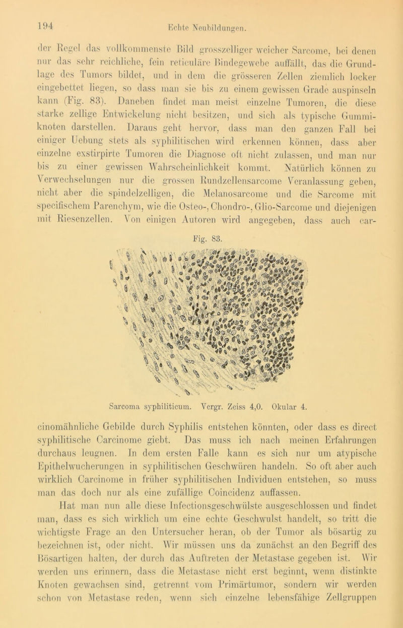 der Regel das vollkommenste Bild grosszelliger weicher Sarcome, bei denen nur das sehr reichliche, fein reticuläre Bindegewebe auflallt, das die Grund- lage des Tumors bildet, und in dem die grösseren Zellen ziemlich locker eingebettet liegen, so dass man sic bis zu einem gewissen Grade auspinseln kann (Big. 83). Daneben findet man meist einzelne Tumoren, die diese starke zeitige Entwickelung nicht besitzen, und sich als typische Gummi- knoten darstellen. Daraus geht hervor, dass man den ganzen Fall bei einiger Hebung stets als syphilitischen wird erkennen können, dass aber einzelne exstirpirte Tumoren die Diagnose oft nicht zulassen, und man nur bis zu einer gewissen Wahrscheinlichkeit kommt. Natürlich können zu Verwechselungen nur die grossen Bundzcllensarcomc Veranlassung geben, nicht aber die spindelzelligen, die Melanosarcome und die Sarcome mit specifischem Parenchym, wie die Osteo-, Chondro-, Glio-Sarcome und diejenigen mit Riesenzellen. Von einigen Autoren wird angegeben, dass auch car- Fig. 83. Sarcoma syphiliticum. Yergr. Zeiss 4,0. Okular 4. cinomähnliche Gebilde durch Syphilis entstehen könnten, oder dass es direct syphilitische Carcinome giebt. Das muss ich nach meinen Erfahrungen durchaus leugnen. In dem ersten Falle kann es sich nur um atypische Epithelwucherungen in syphilitischen Geschwüren handeln. So oft aber auch wirklich Carcinome in früher syphilitischen Individuen entstehen, so muss man das doch nur als eine zufällige Coincidenz auffassen. Hat man nun alle diese lnfectionsgeschwülste ausgeschlossen und findet man, dass es sich wirklich um eine echte Geschwulst handelt, so tritt die wichtigste Frage an den Untersucher heran, ob der Tumor als bösartig zu bezeichnen ist, oder nicht. Wir müssen uns da zunächst an den Begriff des Bösartigen halten, der durch das Auftreten der Metastase gegeben ist. Wir werden uns erinnern, dass die Metastase nicht erst beginnt, wenn distinktc Knoten gewachsen sind, getrennt vom Primärtumor, sondern wir werden schon von Metastase reden, wenn sich einzelne lebensfähige Zellgruppen
