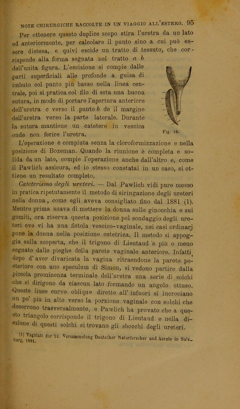 Per ottenere questo duplice scopo stira l’uretra da un lato «d anteriormente, per calcolare il punto sino a cui può es- sere distesa, e quivi escide un tratto di tessuto, che cor- risponde alla forma segnata nel tratto a b •dell’unita figura. L’escisione si compie dalle parti superficiali alle profonde a guisa di imbuto col punto più basso nella linea cen- trale, poi si pratica col filo di seta una buona sutura, in modo di portare l’apertura anteriore dell’uretra c verso il punto b de il margine dell’uretra verso la parte laterale. Durante la sutura mantiene un catetere in vescica onde non ferire l’uretra. L’operazione è compiuta senza la cloroformizzazione e nella posizione di Bozeman. Quando la riunione è completa e so- lida da un lato, compie l’operazione anche dall’altro e, come il Pawlich assicura, ed io stesso constatai in un caso, si ot- tiene un resultato completo. Cateterismo degli ureteri. — Dal Pawlich vidi pure messo in pratica ripetutamente il metodo di siringazione degli ureteri nella donna , come egli aveva consigliato fino dal 1881 (1). Mentre prima usava di mettere la donna sulle ginocchia e sui gomiti, ora riserva questa posizione pel sondaggio degli ure- teri ove vi ha una fìstola vescico-vaginale, nei casi ordinarj pone la donna nella posizione ostetrica. 11 metodo si appog- gia sulla scoperta, che il trigono di Lieutaud 'è più o meno segnato dalle pieghe della parete vaginale anteriore. Infatti dopo d aver divaricata la vagina ritraendone la parete po- steriore con uno speculum di Simon, si vedono partire dalla piccola prominenza terminale dell'uretra una serie di solchi ■che si dirigono da ciascun lato formando un angolo ottuso. Queste linee curve oblique dirette all’ infuori si incrociano un po più in alto verso la porzione vaginale con solchi che decorrono trasversalmente, e Pawlich ha provato che a que- sto triangolo corrisponde il trigono di Lieutaud e nella di- zione di questi solchi si trovano gli sbocchi degli ureteri. ijgj 1T8a8g,Matt der 55' v^ammulung Deutscher Naturforscher and Aeato in Sa!z_