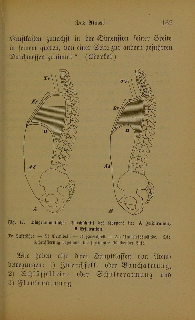 Sruftfaften §unäcfj[t in ber «©imenfion feiner Breite in feinem queren, Don einer ©eite gitr anbern geführten S)urcf)meffer junimmt. (Werfet) gtg. 17. Siagrommatifitjer Smrdjfi&nitt &e§ Börgers in: A ^itfpiratiou, B Gj-fgiratioit. Tr Suftröfjcc — St ©rupeiu — D SiucrcOfett — Ab Uuterleiöälüänbe. ®te Scfjrafftcrung bcäddmet bic ftationörc (bfeibenbe) Suft. SBir ijaben alfo brei §auptflaffen Don Sttem® betoegungen: 1) $ io er cf) feil* ober ©audjatmung, 2) ©djlüffelbein* ober ©djultcratmurtg unb 3) .^tanfenatmung.