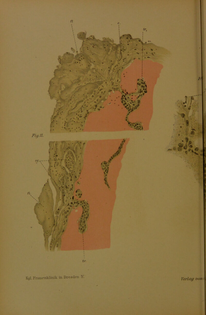 Fig.il. i \ i i tr. Kgl. Frauenklinik in Dresden IV. Verlag von