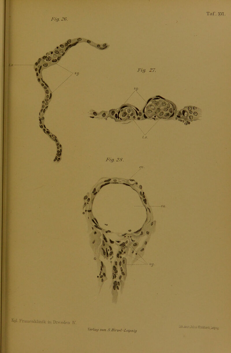 Fi ff. OG. Taf. XVI Kc|].l-Vaiienldinil\. in Dresden IV. üthuAnst. Julius Klinkhardi, L«pzi<;