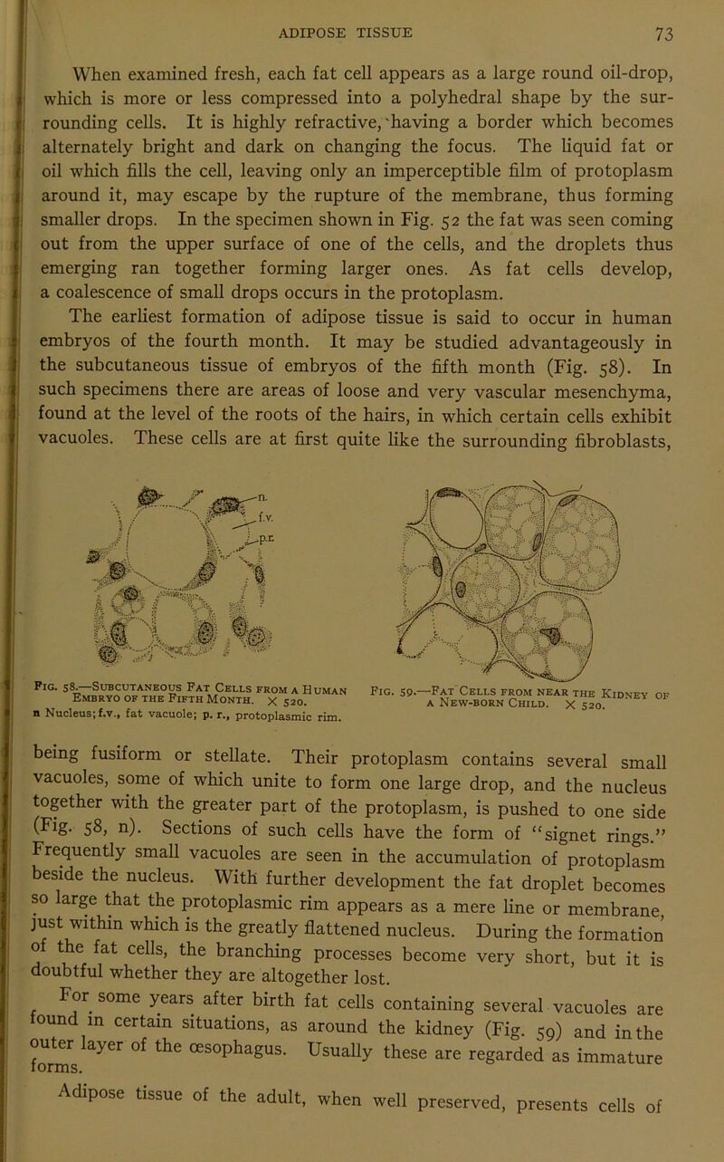When examined fresh, each fat cell appears as a large round oil-drop, which is more or less compressed into a polyhedral shape by the sur- rounding cells. It is highly refractive,'having a border which becomes alternately bright and dark on changing the focus. The liquid fat or oil which fills the cell, leaving only an imperceptible film of protoplasm around it, may escape by the rupture of the membrane, thus forming smaller drops. In the specimen shown in Fig. 52 the fat was seen coming out from the upper surface of one of the cells, and the droplets thus emerging ran together forming larger ones. As fat cells develop, a coalescence of small drops occurs in the protoplasm. The earliest formation of adipose tissue is said to occur in human embryos of the fourth month. It may be studied advantageously in the subcutaneous tissue of embryos of the fifth month (Fig. 58). In such specimens there are areas of loose and very vascular mesenchyma, found at the level of the roots of the hairs, in which certain cells exhibit vacuoles. These cells are at first quite like the surrounding fibroblasts, Pig. 58.—Subcutaneous Pat Cells from a Human Embryo of the Fifth Month, x 520. n Nucleus; f.v., fat vacuole; p. r., protoplasmic rim. Fig. S9.—Fat Cells from near the Kidney a New-born Child. X 520. of being fusiform or stellate. Their protoplasm contains several small vacuoles, some of which unite to form one large drop, and the nucleus together with the greater part of the protoplasm, is pushed to one side (Fig. 58, n). Sections of such cells have the form of “signet rings.” Frequently small vacuoles are seen in the accumulation of protoplasm beside the nucleus. With further development the fat droplet becomes so large that the protoplasmic rim appears as a mere line or membrane, just within which is the greatly flattened nucleus. During the formation o the fat cells, the branching processes become very short, but it is doubtful whether they are altogether lost. For some years after birth fat cells containing several vacuoles are iound in certain situations, as around the kidney (Fig. cQ) and in the formskyer °f the °eSOphagUS- UsuallF these are regarded as immature Adipose tissue of the adult, when well preserved, presents cells of