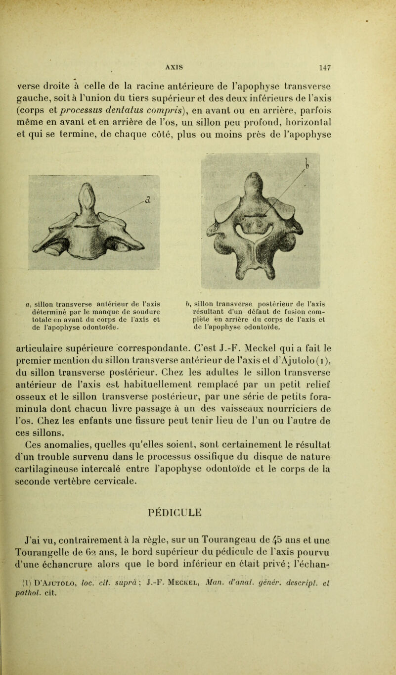 verse droite à celle de la racine antérieure de l’apophyse transverse gauche, soit à l’union du tiers supérieur et des deux inférieurs de l’axis (corps et processus dentatus compris)^ en avant ou en arrière, parfois même en avant et en arrière de l’os, un sillon peu profond, horizontal et qui se termine, de chaque côté, plus ou moins près de l’apophyse a, sillon transverse antérieur de l’axis déterminé par le manque de soudure totale en avant du corps de l’axis et de l’apophyse odontoïde. 6, sillon transverse postérieur de l’axis résultant d’un défaut de fusion com- plète en arrière du corps de l’axis et de l’apophyse odontoïde. articulaire supérieure correspondante. C’est J.-F. Meckel qui a fait le premier mention du sillon transverse antérieur de l’axis et d’Ajutolo(i), du sillon transverse postérieur. Chez les adultes le sillon transverse antérieur de l’axis est habituellement remplacé par un petit relief osseux et le sillon transverse postérieur, par une série de petits fora- minula dont chacun livre passage à un des vaisseaux nourriciers de l’os. Chez les enfants une fissure peut tenir lieu de l’un ou l’autre de ces sillons. Ces anomalies, quelles qu’elles soient, sont certainement le résultat d’un trouble survenu dans le processus ossifique du disque de nature cartilagineuse intercalé entre l’apophyse odontoïde et le corps de la seconde vertèbre cervicale. PÉDICULE J’ai vu, contrairement à la règle, sur un Tourangeau de 45 ans et une Tourangelle de 62 ans, le bord supérieur du pédicule de l’axis pourvu d’une échancrure alors que le bord inférieur en était privé ; l’échan- (1) D’Ajutolo, loc. cif. suprà ; J.-F. Meckel, Man. d’anat. génér. descripl. el pathol. cit.