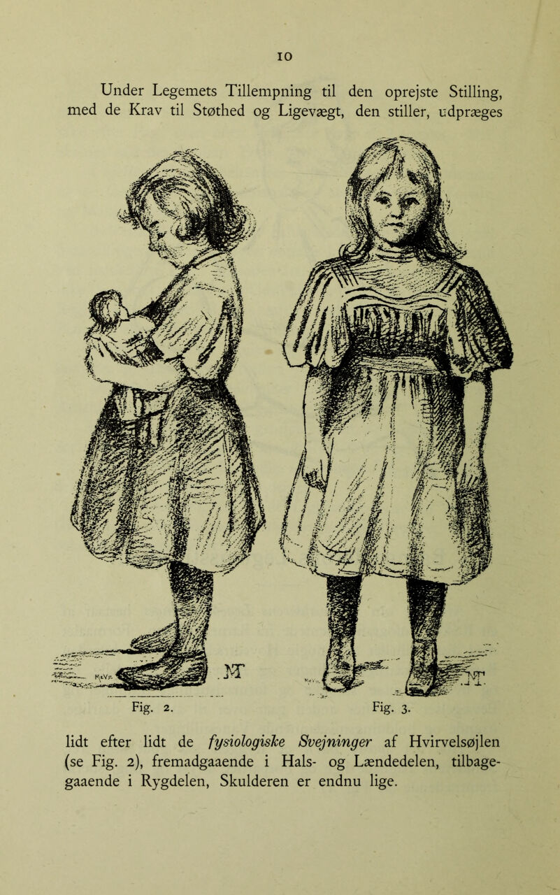 Under Legemets Tillempning til den oprejste Stilling, med de Krav til Støthed og Ligevægt, den stiller, udpræges Fig. 2. Fig. 3. lidt efter lidt de fysiologiske Svejninger af Hvirvelsøjlen (se Fig. 2), fremadgaaende i Hals- og Lændedelen, tilbage- gaaende i Rygdelen, Skulderen er endnu lige.