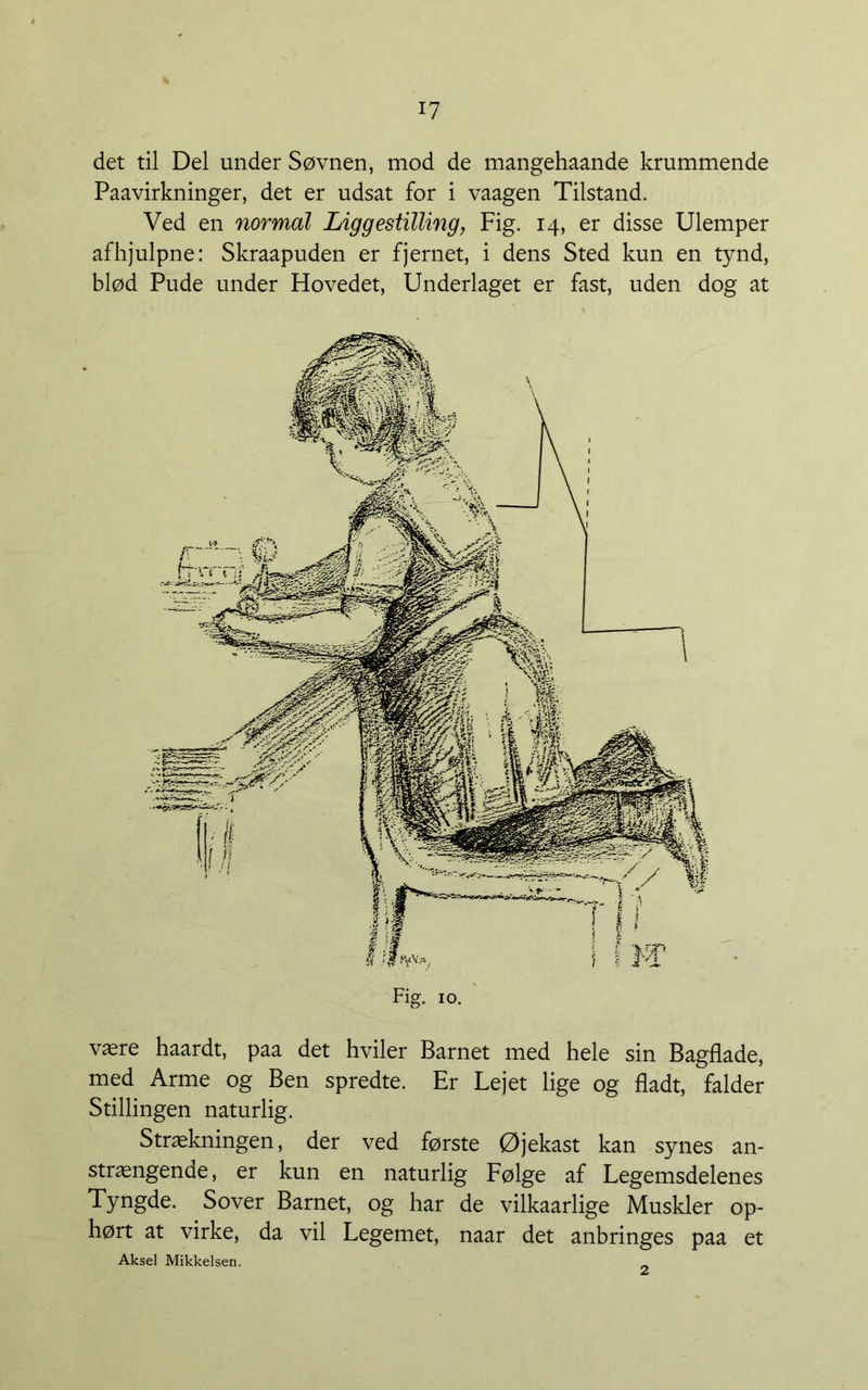 det til Del under Søvnen, mod de mangehaande krummende Paavirkninger, det er udsat for i vaagen Tilstand. Ved en normal Liggestilling, Fig. 14, er disse Ulemper afhjulpne: Skraapuden er fjernet, i dens Sted kun en tynd, blød Pude under Hovedet, Underlaget er fast, uden dog at Fig. 10. være haardt, paa det hviler Barnet med hele sin Bagflade, med Arme og Ben spredte. Er Lejet lige og fladt, falder Stillingen naturlig. Strækningen, der ved første Øjekast kan synes an- strængende, er kun en naturlig Følge af Legemsdelenes Tyngde. Sover Barnet, og har de vilkaarlige Muskler op- hørt at virke, da vil Legemet, naar det anbringes paa et Aksel Mikkelsen. .