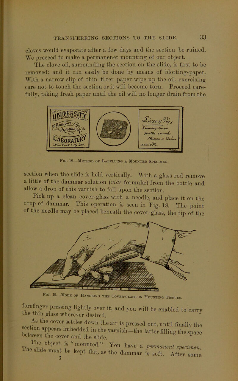 cloves would evaporate after a few clays and the section be ruined. We proceed to make a permanenet mounting of our object. The clove oil, surrounding the section on the slide, is first to be removed; and it can easily be done by means of blotting-paper. With a narrow slip of thin filter paper wipe up the oil, exercising care not to touch the section or it will become torn. Proceed care- fully, taking fresh paper until the oil will no longer drain from the A^PatH£L«»gv> ^ABORATfl^ 'Wa,: y-.,rkr Cit'v.US. (S) ip % j S/cCucta. </ TULrZT' Fig. 18.—Method of Labelling a Mounted Specimen. section when the slide is held vertically. TVdth <i glass rod remove a little of the dammar solution (vide formulas) from the bottle and allow a drop of this varnish to fall upon the section. Pick up a clean cover-glass with a needle, and place it on the drop of dammar. This operation is seen in Fig. 18. The point of the needle may be placed beneath the cover-glass, the tip of the Fig. 19.—Mode of Handling the Cover-glass in Mounting Tissues. forefinger pressing lightly over it, and you will be enabled to carry tne thin glass wherever desired. As the cover settles down the air is pressed out, until finally the &ec ion appears imbedded in the varnish—the latter filling the space between the cover and the slide. 1 The^slif]p0rn°°t r r™ted” Y0U have a Permanent specimen.. Itie slide must be kept flat, as the dammar is soft. After some 3