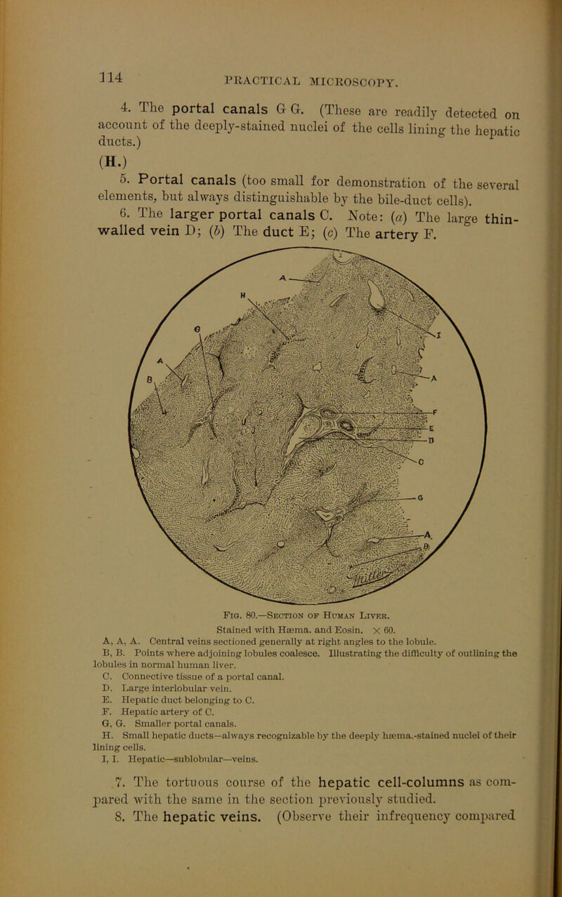 4. The portal canals G G. (These are readily detected on account of the deeply-stained nuclei of the cells lining the hepatic ducts.) (H.) 5. Portal canals (too small for demonstration of the several elements, hut always distinguishable by the bile-duct cells). 6. The larger portal canals C. Note: (a) The large thin- walled vein D; (b) The duct E; (c) The artery F. Fig. 80.—Section of Human Livf.r. Stained with Hsema. and Eosin. x 60. A. A, A. Central veins sectioned generally at right angles to the lobule. B. B. Points where adjoining lobules coalesce. Illustrating the difficulty of outlining the lobules in normal human liver. C. Connective tissue of a portal canal. D. Large interlobular vein. E. Hepatic duct belonging to C. F. Hepatic artery of C. G. G. Smaller portal canals. H. Small hepatic ducts—always recognizable by the deeply h;ema.-stained nuclei of their lining cells. I. I. Hepatic—sublobular—veins. .7. The tortuous course of the hepatic cell-columns as com- pared with the same in the section previously studied. 8. The hepatic veins. (Observe their infrequency compared
